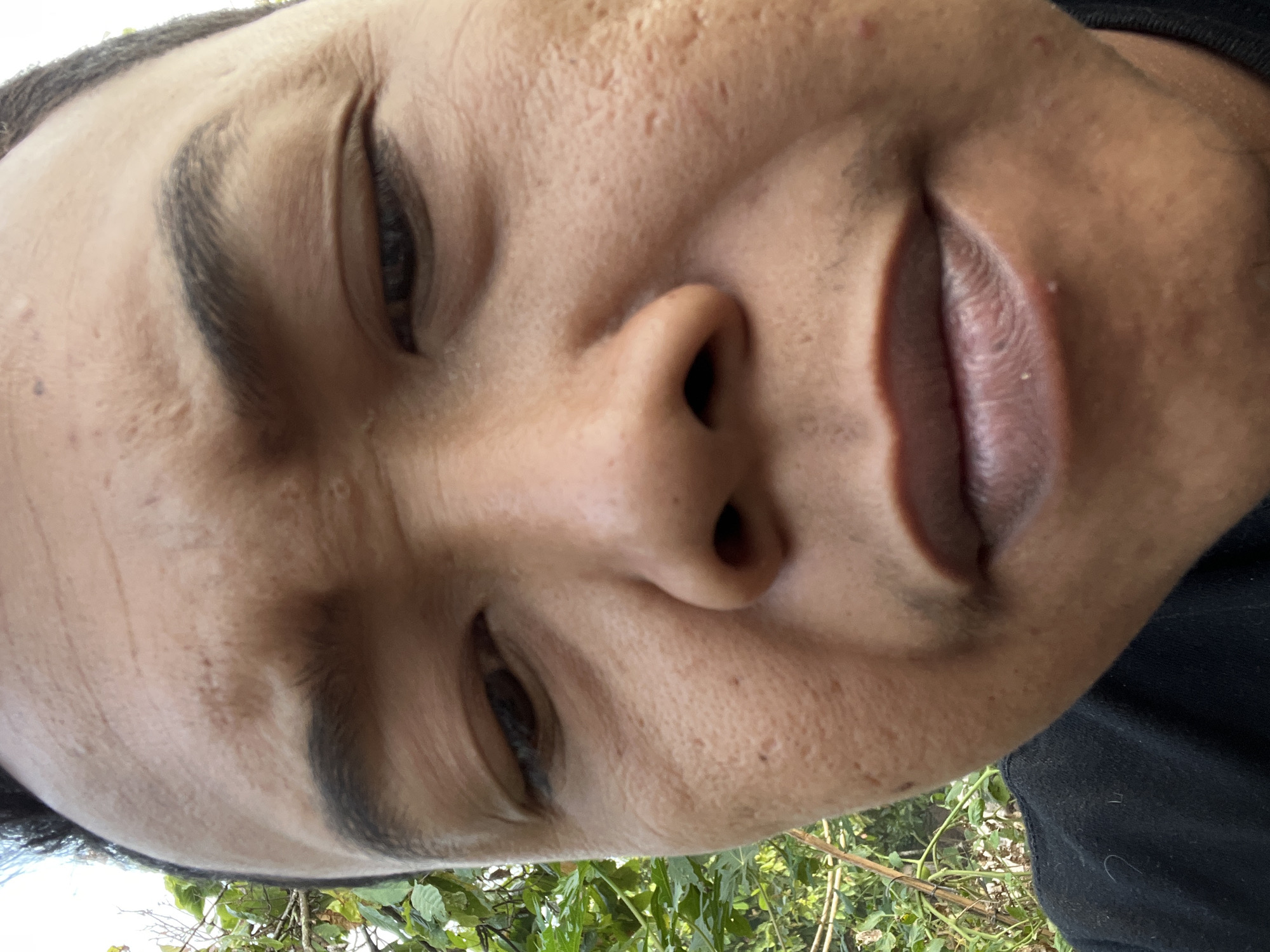 The close-up, low-angle selfie shows a person's face, with the top of their head and shoulders visible. The person has dark hair and eyebrows, and their skin shows texture, including pores and some scarring. Their eyes are looking downwards. They are wearing a black shirt. The background is out of focus but appears to be outdoors, with greenery and some branches visible. The image was taken in Kebumen, Indonesia.