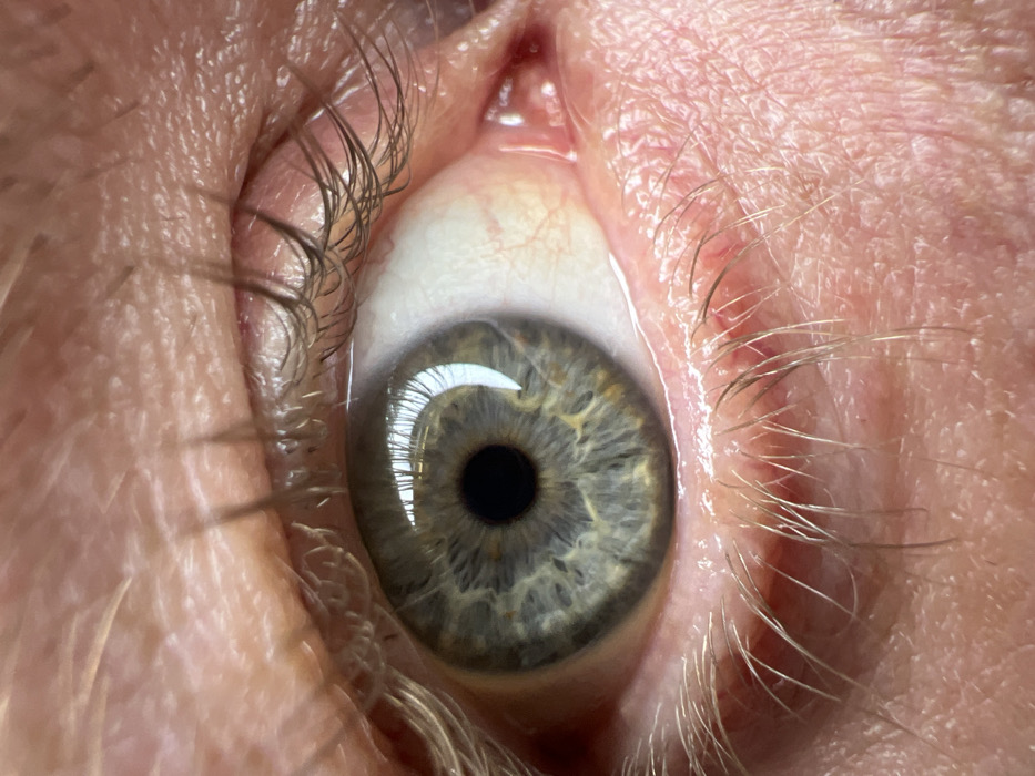 A highly magnified, close-up image depicts a human eye. The scene is located in Saint Petersburg, Russia. The iris displays a complex pattern of blue, green, and hazel tones, with a central dark pupil. A distinct, elongated reflection of an external light source, likely a window, is visible on the cornea's surface. The sclera is primarily white, traversed by several fine red capillaries, particularly pronounced near the inner canthus. Eyelashes are present on both upper and lower lids, with the upper lashes appearing darker and more numerous. The surrounding skin exhibits fine lines and light-colored vellus hair.
