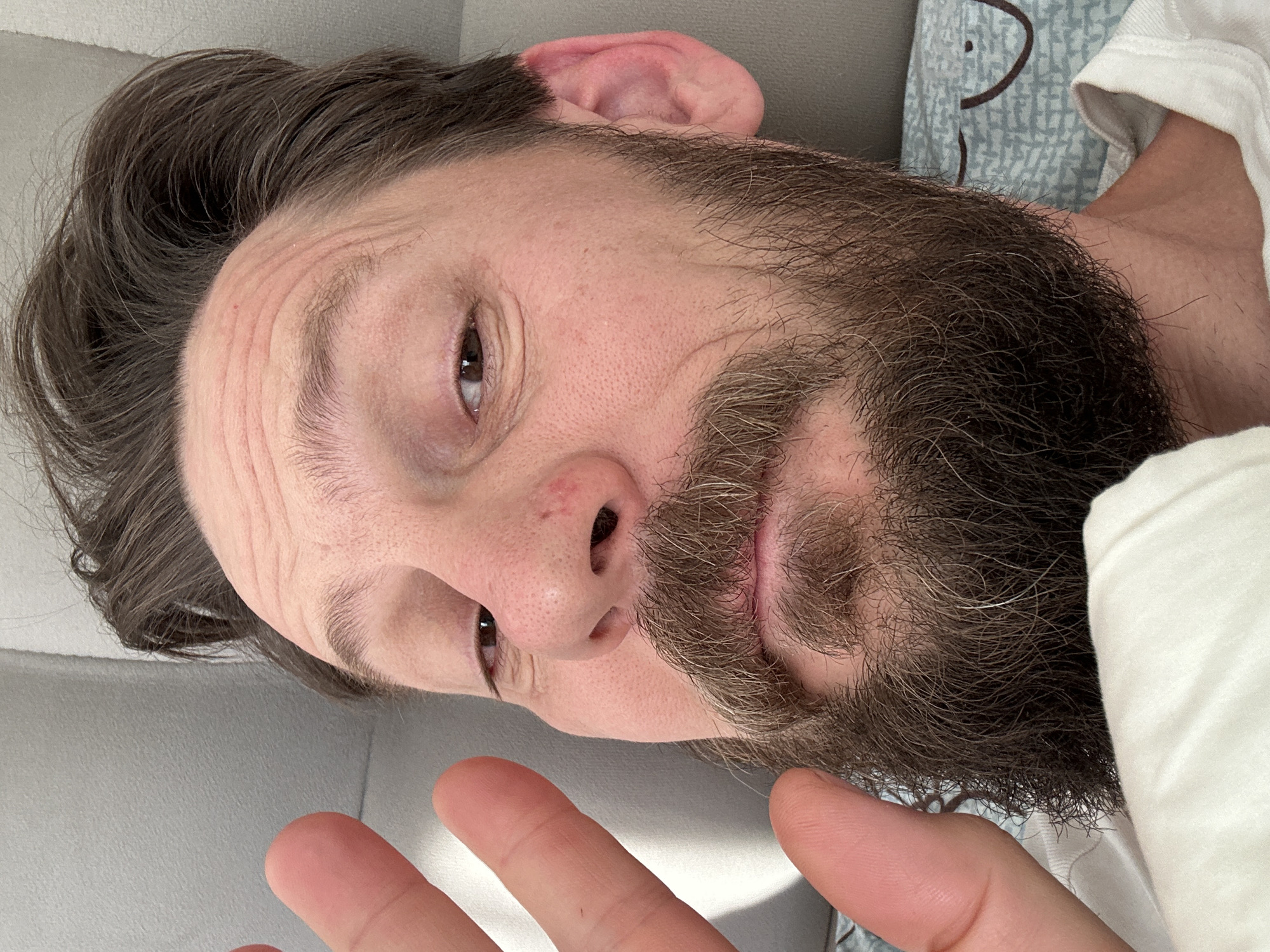 A close-up, overhead portrait depicts a man, likely in Fethiye, Turkey, lying on his back or side and looking directly at the camera. He appears to be middle-aged, with fair skin, dark brown hair, and a full, thick beard and mustache that include visible gray strands. Prominent wrinkles are noticeable across his forehead and around his left eye, which is clearly visible and dark brown. A small red mark or blemish is present on his nose.
The man's expression is neutral and contemplative, conveying a sense of relaxation or thoughtfulness as he gazes upwards. He is wearing a plain white T-shirt, partially visible on his right shoulder and upper arm. Behind his head, a light blue fabric with a subtle pattern, possibly bedding or another piece of clothing, suggests an indoor setting such as a bedroom. The immediate background behind his head is a plain, light gray or off-white surface, possibly a pillow or headboard.
In the lower foreground, the man's right hand is partially visible with fingers outstretched towards the camera, suggesting he might be holding the camera for a selfie or simply resting his hand. The lighting is soft and even, indicating diffused indoor illumination or indirect natural light, without strong shadows. There is no visible text in the image.