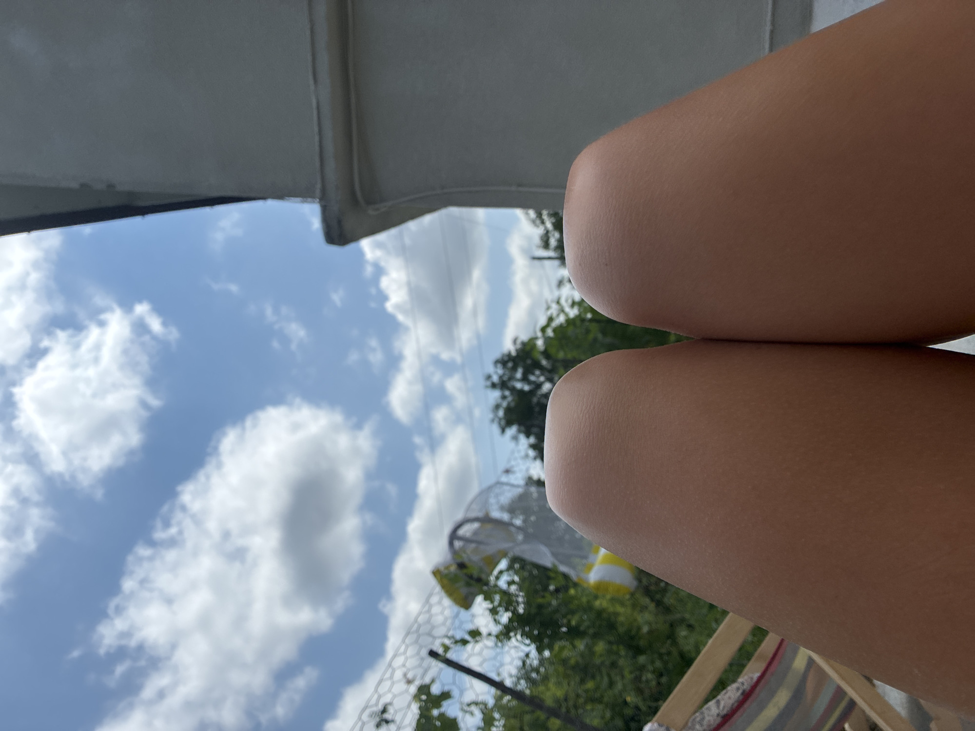 The image shows a close-up view of two human knees, likely from a female, against a backdrop of a blue sky with scattered white clouds. To the left, there is greenery, a wire fence, and a hammock with striped fabric. On the right, a portion of a gray building is visible. The setting appears to be outdoors, possibly in a backyard or garden area, under a bright sky. The focus is on the texture and skin tone of the knees, suggesting a sunny day. There is no information in the image that would place the scene specifically in Surami, Georgia.