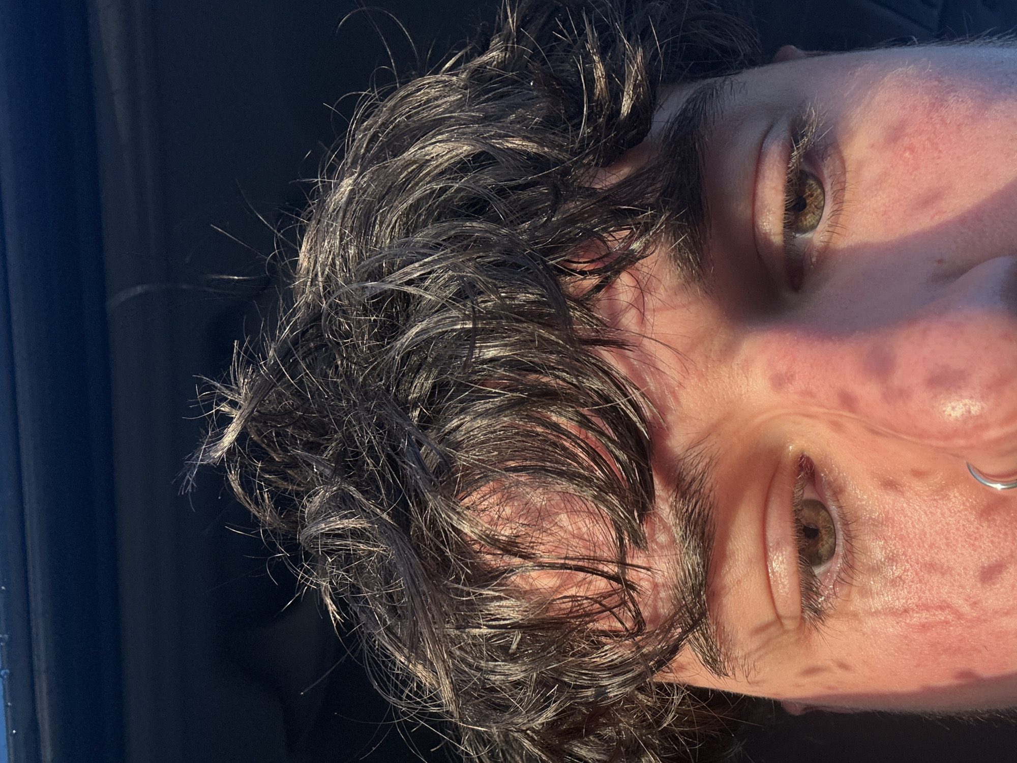 A close-up photograph shows a person's face from a slightly upward angle. The person has dark, wet hair, light skin with some red marks or blemishes, and brown eyes. An earring is visible on the lower part of the person's face. The background appears to be dark. The location is Unknown, Unknown.
