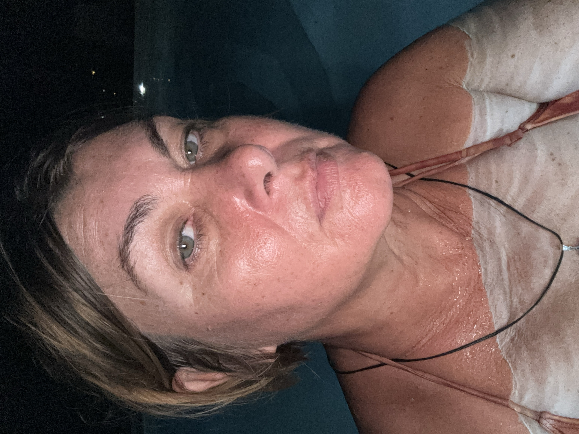 An adult female is depicted in a close-up, chest-up shot, immersed in dark water at night in บ้านบางรักษ์, Thailand. She faces the camera directly, illuminated by an unseen light source. Her hair is short, light brown, and appears wet. Her eyes are light-colored, and her facial skin displays a tanned or reddened complexion with visible fine lines. Her expression is neutral, with her lips slightly parted. Distinct white, wavy patterns and patches are visible across her chest, shoulders, and upper arms, contrasting sharply with her tanned or reddened skin, appearing as if a substance has been applied or partially removed. She wears a light-colored swimsuit top and a thin, dark cord necklace with a small, light-colored pendant. The water surrounding her is dark blue-green. The background is an indistinct dark expanse, indicating an outdoor, nighttime setting, with several small, distant artificial lights visible on the upper right horizon.