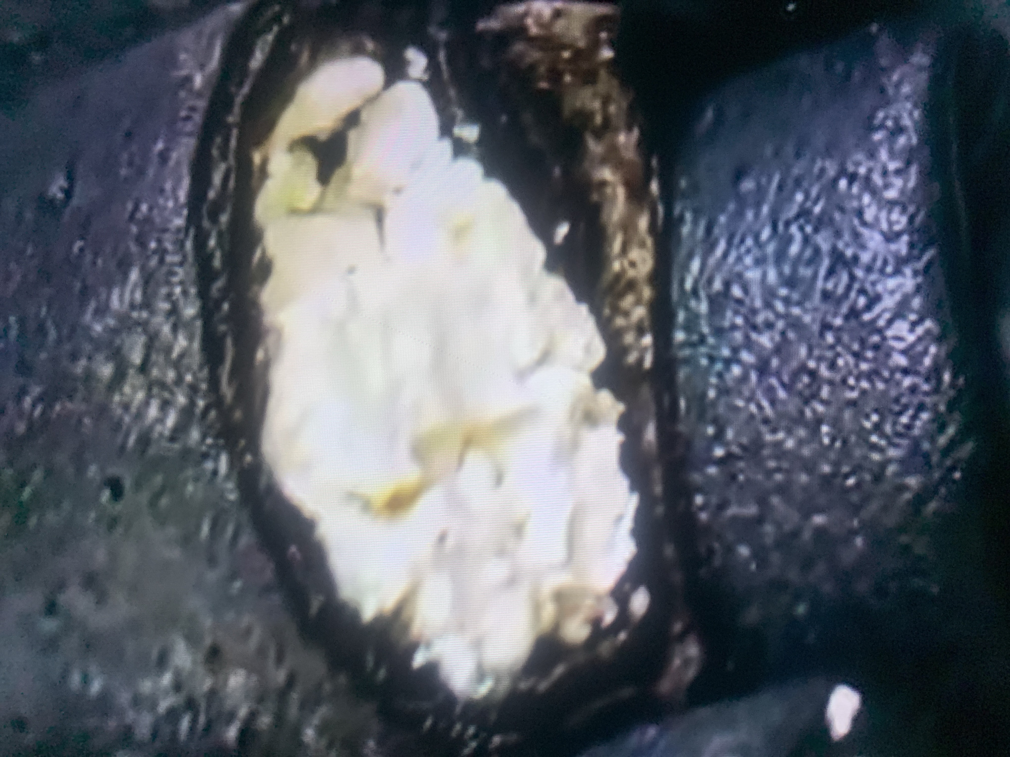 The image is a close-up, blurry, and pixelated view of what appears to be a light-colored, lumpy substance contained within a dark, roughly oval-shaped structure. The substance is predominantly white with some yellowish or light brown hues visible. It has an uneven texture, with individual pieces or clumps discernible. The surrounding dark structure has a rough, textured surface and appears to be part of a larger, dark object. The lighting is not uniform, with some areas of the substance being brightly illuminated, suggesting a light source is present, though its origin is not visible. The overall impression is that of a macro or microscopic view of an organic or semi-solid material within a containment. There is no discernible scene, setting, time of day, weather, location cues, or emotions. No text is visible in the image. The crops provided offer slightly closer views of different parts of the substance and its container, emphasizing the texture and color variations.