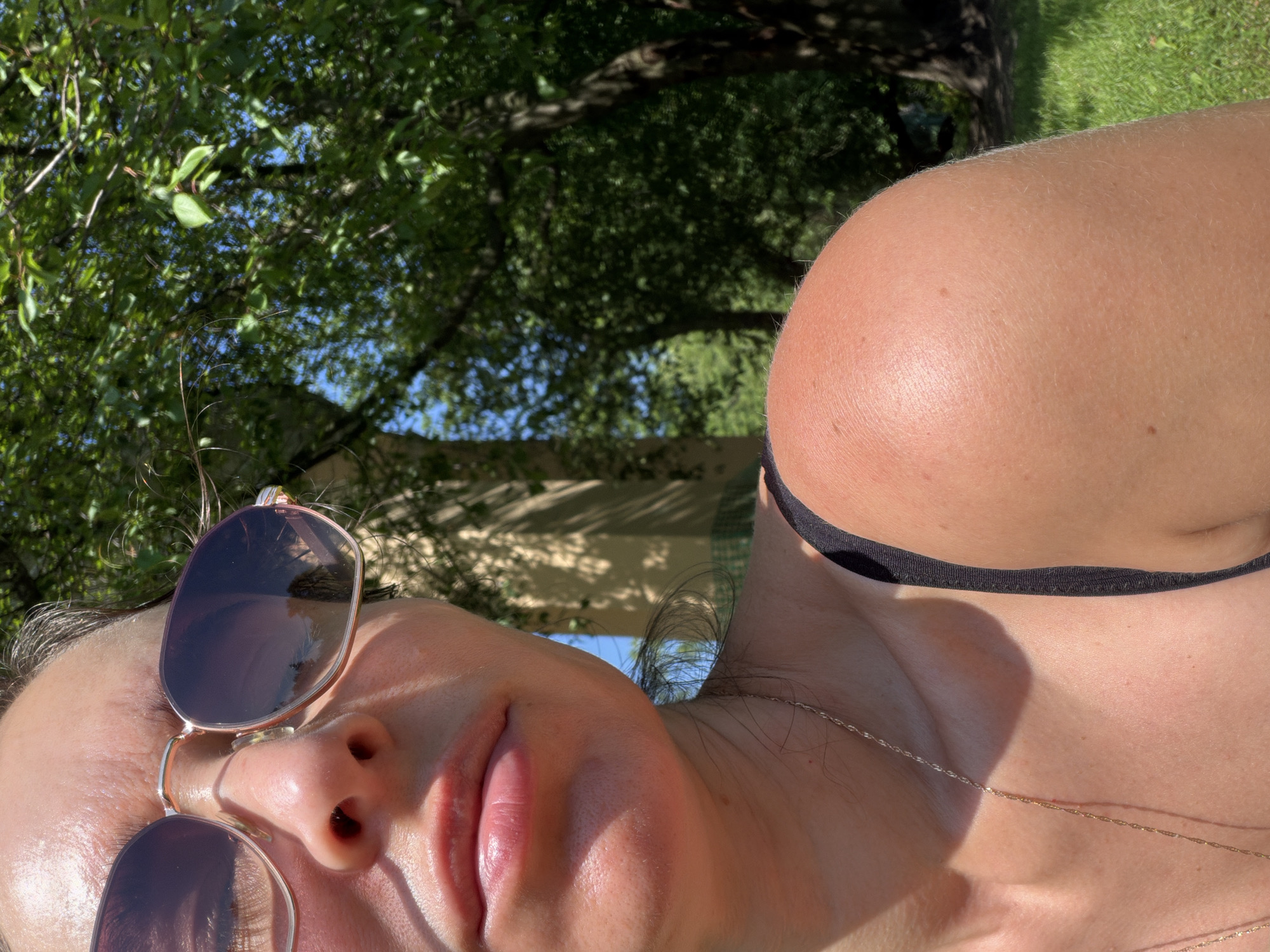 The image is a close-up, outdoor shot of a person's face and shoulder, with lush green trees and a clear blue sky in the background. The person is wearing sunglasses and a black tank top, and their skin appears flushed, suggesting sunburn. The lighting suggests it is daytime, likely sunny. The background hints at a park or garden setting, possibly within the city of Saint Petersburg, Russia, given the characteristic trees and architecture visible in the distance.