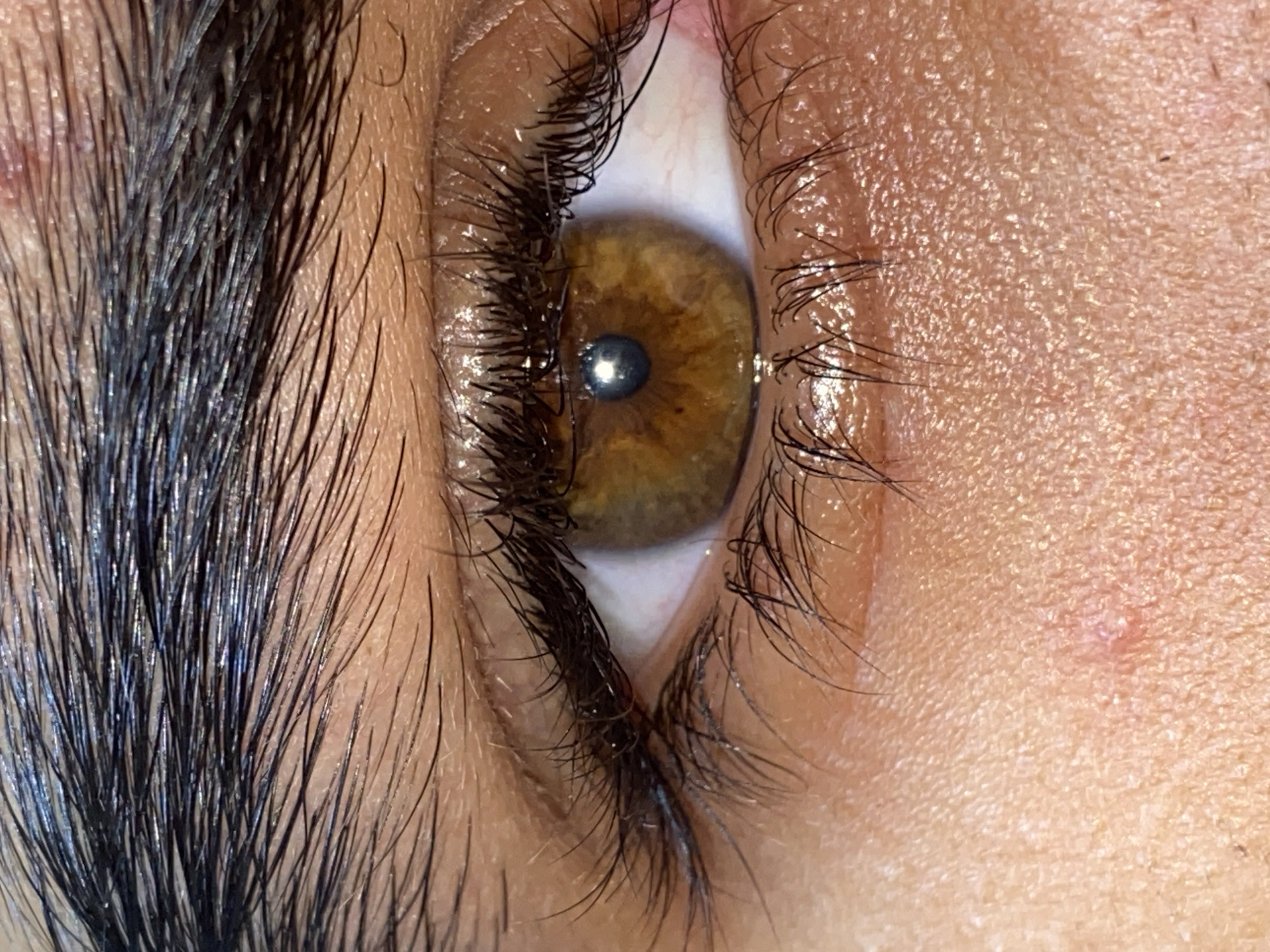 A close-up image shows a human eye with a brown iris, surrounded by dark eyelashes. The skin around the eye is fair, with visible pores and some minor blemishes. Part of a dark eyebrow is visible in the upper left corner of the image. No information can be extracted about the location in Juan Griego, Venezuela.