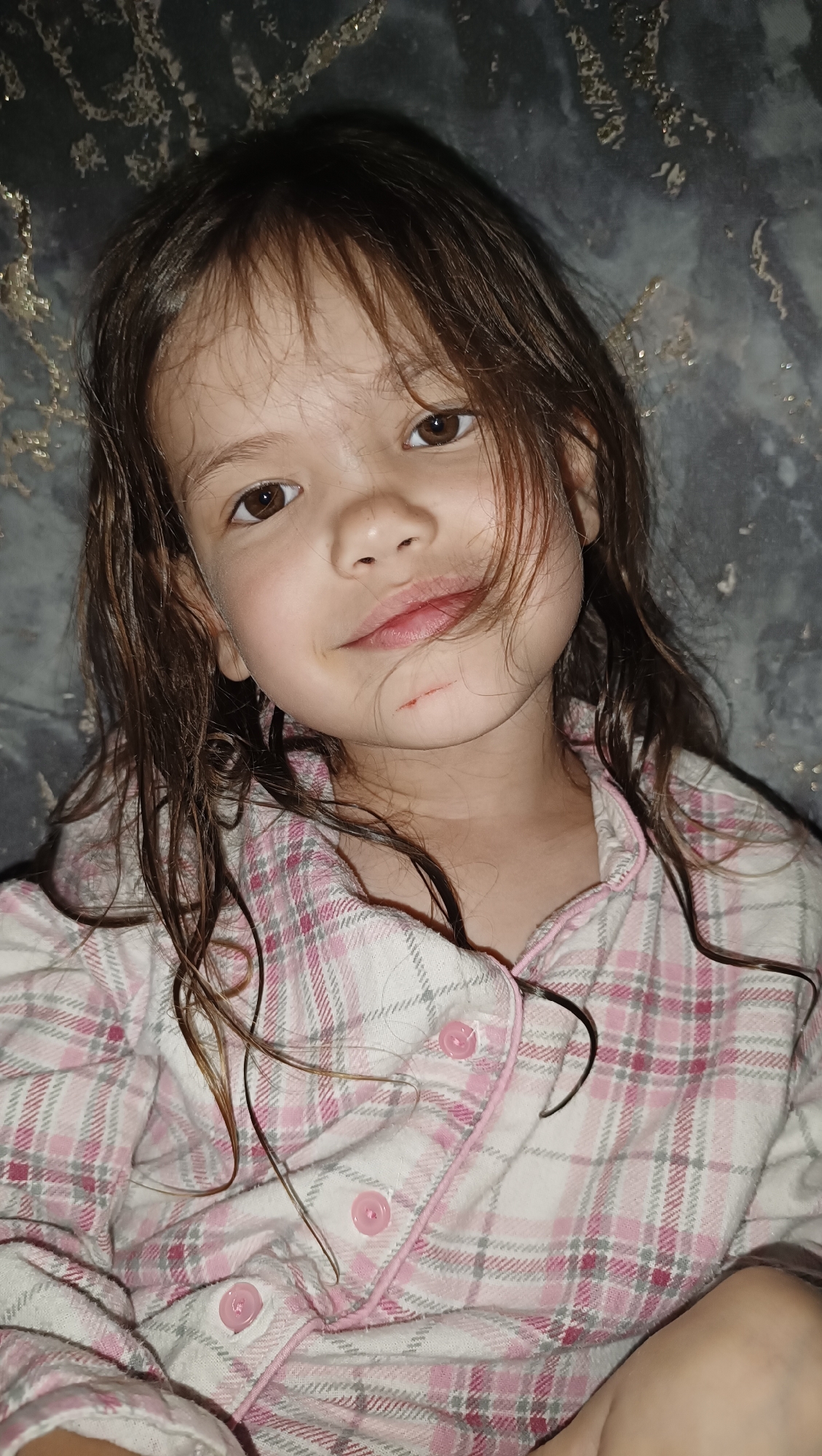 The image shows a close-up, head-and-shoulders portrait of a young girl with brown hair and brown eyes. She is wearing pink and white plaid pajamas. There is a small scratch on her chin, which appears to be slightly red. The background is dark and textured, with some glinting elements. The setting does not provide any specific information about the city of Karsha, Russia.