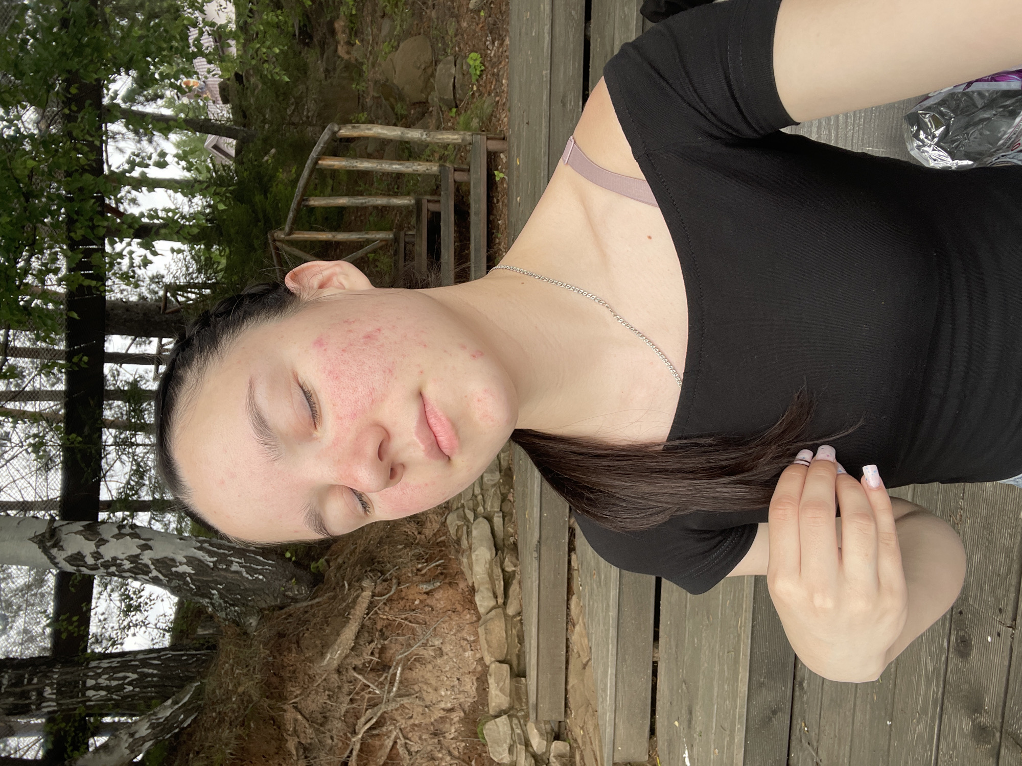 The media file shows a close-up of a young woman with her eyes closed, resting her head on a tree root. She is wearing a black t-shirt and a silver chain necklace. Her skin has some redness and blemishes. Her hand, with white-speckled nail polish, rests on her arm. The background features a wooden walkway, trees with lush green foliage, and a rustic wooden staircase. The scene appears to be outdoors in a natural setting, possibly a park or forest. The lighting suggests it is daytime. The overall impression is one of relaxation and quiet contemplation in a natural environment.
