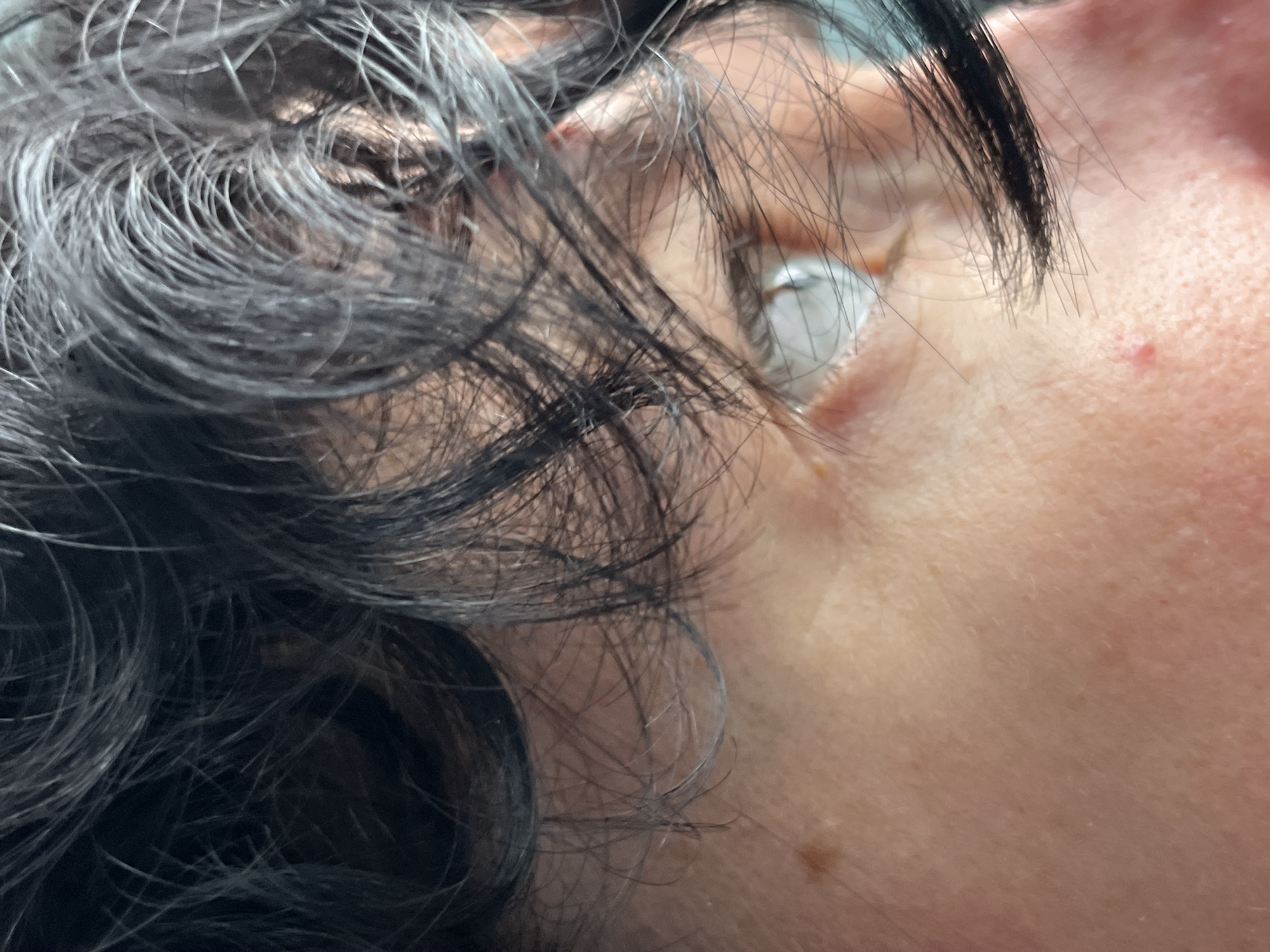 The image is a close-up of a person's face, focusing on their eye and hair. The person has dark, wavy hair that partially obscures their eye. The eye appears to be light-colored. The skin has some redness and a small pimple is visible. There is also a mole on the cheek. The lighting suggests an indoor environment. The location information "ღრმაღელის თემი, Georgia" is associated with this image, indicating it was taken in the Ghrmaghele community, Georgia.