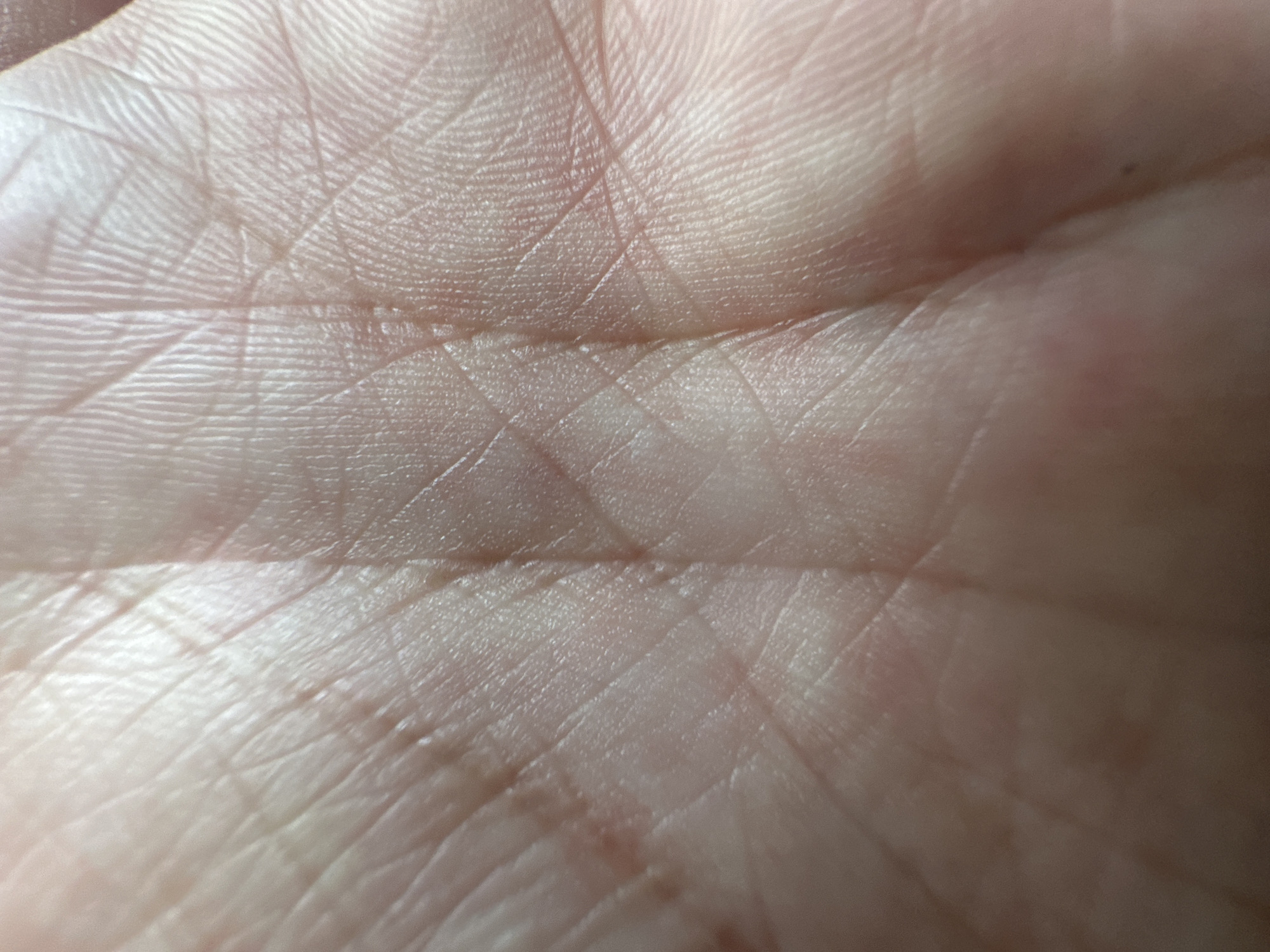 The image is an extreme close-up of a human palm, showing the intricate lines and texture of the skin. The focus is entirely on the skin's surface, with no other objects or people visible. The lighting creates a soft, diffused glow, highlighting the ridges of the palm lines and creating subtle shadows that emphasize the skin's topography. There are no indications of the time of day, weather, or specific location beyond what can be inferred from the subject matter itself. The image conveys a sense of the natural, organic details of the human body, but no specific activity or emotion is depicted. There is no visible text in the image. The context of Belgrade, Serbia, does not provide any additional visual cues within the image itself.