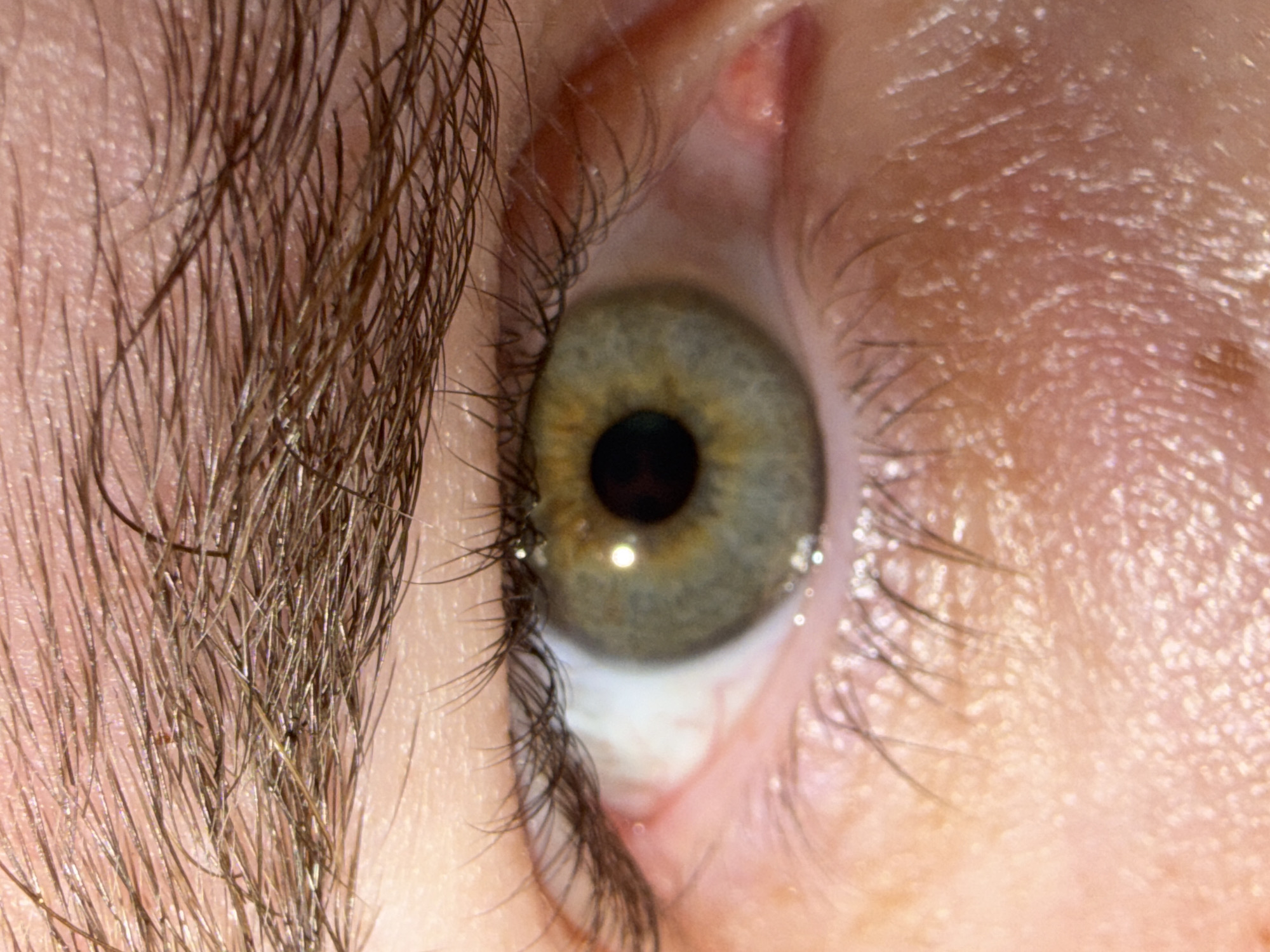 A close-up image shows a human eye with a light green iris and dark pupil. The skin around the eye is visible, with eyelashes extending outward. The left side of the image shows the edge of a person's eyebrow. The image provides no information about the location in the city of Chaikovsky, Russia.