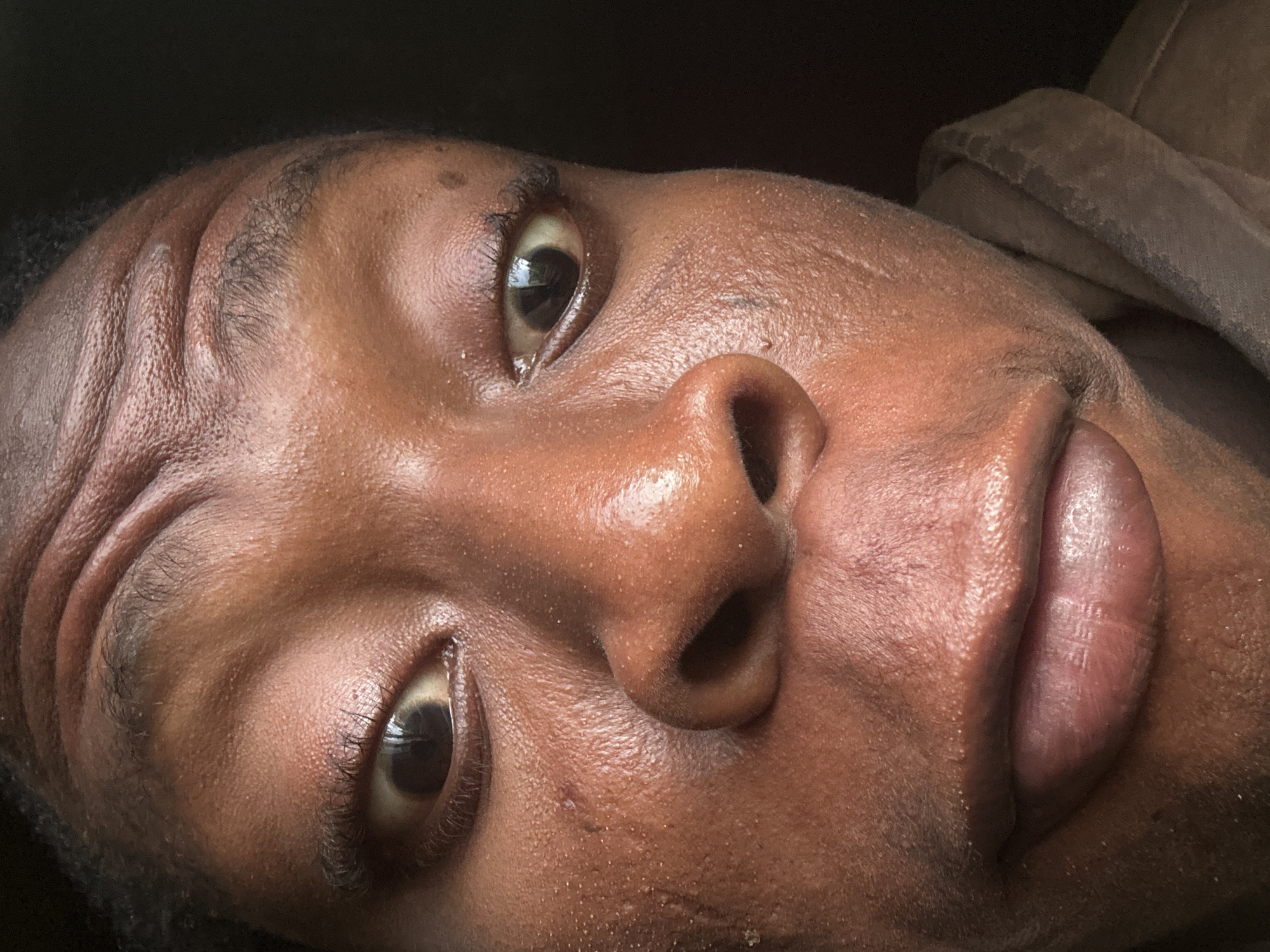 A close-up, downward-tilted shot features a person's face. The individual has dark skin and features prominent eyes with visible eyelashes, a fleshy nose, and full lips. The skin appears slightly oily and textured. Wrinkles are visible on the forehead. Part of a tan garment is visible on the top right edge of the image. The background is dark. The image provides no information about the city or location.