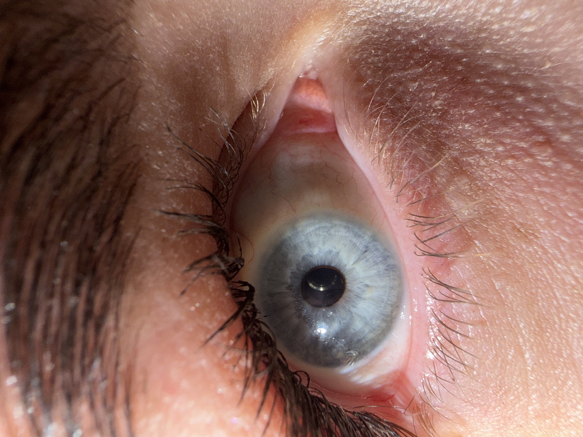 A close-up image of a human eye. The iris is a light blue-gray color. Eyelashes are visible, and the surrounding skin shows some fine lines and texture. The image appears to have been taken in a controlled lighting environment. The location is Unknown, Unknown.