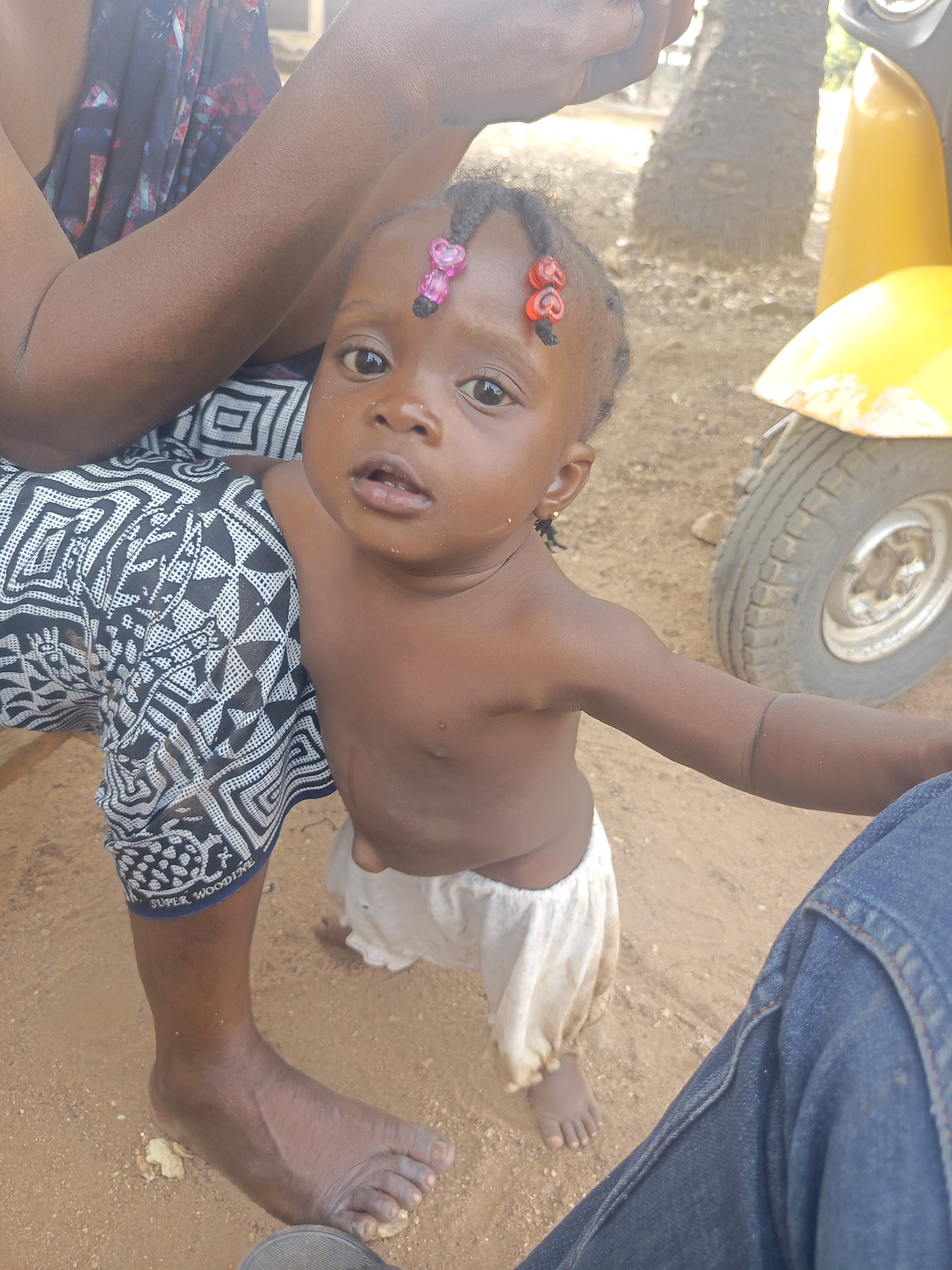 A partially unclothed infant stands on sandy ground outdoors, leaning slightly towards the right of the frame. The infant has dark skin and a small braid of hair decorated with pink and red beads. They wear light-colored, loose-fitting shorts. An adult's legs are partially visible on the left and right of the frame. The adult on the left has dark skin and is wearing a patterned garment; on the right, the adult is wearing blue jeans. A yellow vehicle with a visible tire is in the background to the right. The ground is sandy, and there are trees visible in the distance. The location is presumed to be Akwanga, Nigeria.
