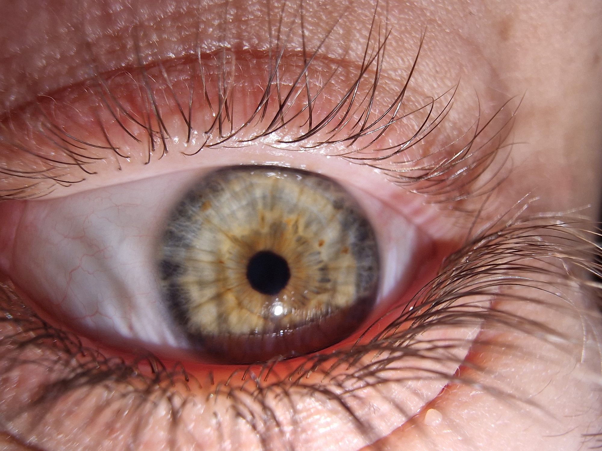 A macro, close-up photograph captures a single human eye, dominated by a striking hazel-colored iris. The iris exhibits a complex pattern, transitioning from a warm golden-brown or amber hue around the pupil to an outer ring of greenish-grey or blue-grey. Numerous tiny, dark specks are visible within the iris's intricate texture. The pupil is black, round, and moderately dilated, reflecting a small point of light.
The white sclera of the eye is visible, particularly towards the inner (nasal) side, and is threaded with fine, delicate red blood vessels. Long, dark brown or black eyelashes frame the eye, curving upwards from the upper eyelid and downwards from the lower eyelid. The skin of the eyelids appears fair, showing natural texture, pores, and subtle lines, indicative of human skin. Some of the crops highlight the detailed structure of individual eyelashes and the skin surface. One crop also reveals a small, light-colored bump or deposit near the lower lash line.
The lighting is bright, illuminating the eye's details with clarity and creating subtle reflections on the eye's surface, enhancing its wet appearance. The focus is exceptionally sharp on the iris and lashes, bringing out their minute characteristics. The overall impression is one of intense detail and vibrant color, showcasing the biological intricacies of the human eye.