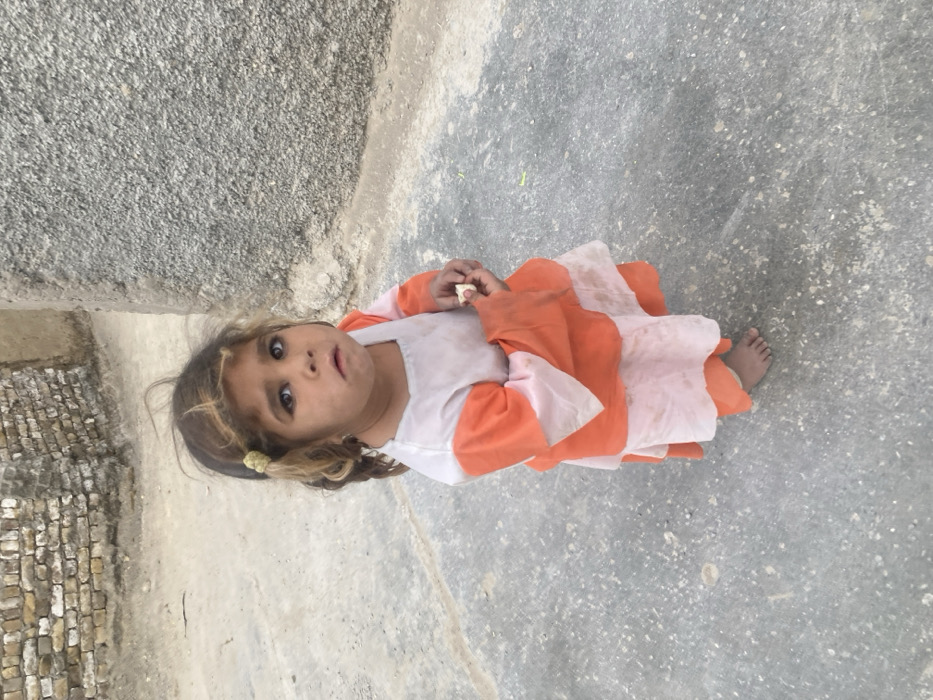 This image depicts a young child, approximately 3-6 years old, standing barefoot on a light gray paved surface in what is identified as Quetta City Tehsil, Pakistan. The child has dark eyes and dark hair with lighter, possibly sun-bleached, streaks, styled into two small pigtails secured with yellow hair ties. Visible smudges are present on the child's face. The child wears a soiled, layered garment, primarily white or light pink with orange sections, and holds a small, light-colored object, consistent with a piece of food, in both hands near the chest. The child is looking directly at the camera. In the background, to the left, a weathered wall constructed from irregular, light-colored stone or brick is visible. To the right, a textured, darker gray wall with a rough finish forms part of the environment. The scene is illuminated by natural daylight.