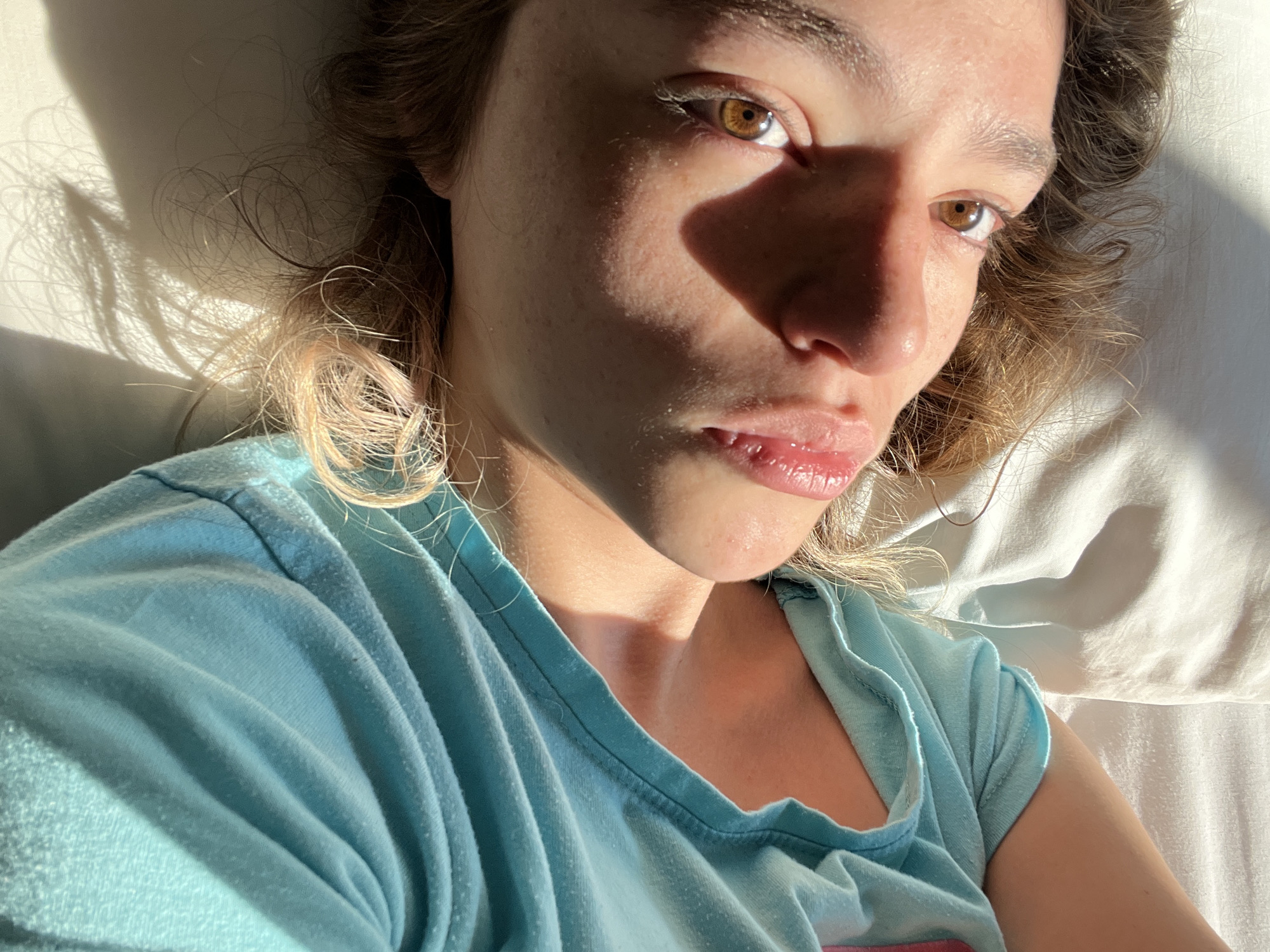A person with light skin and brown eyes is lying down on a white surface, possibly a bed. They are wearing a light blue t-shirt. The person is facing the camera with their head slightly tilted. Sunlight casts a strong shadow across their face. The location in San Bernardino Tlaxcalancingo, Mexico is not discernible from the image.