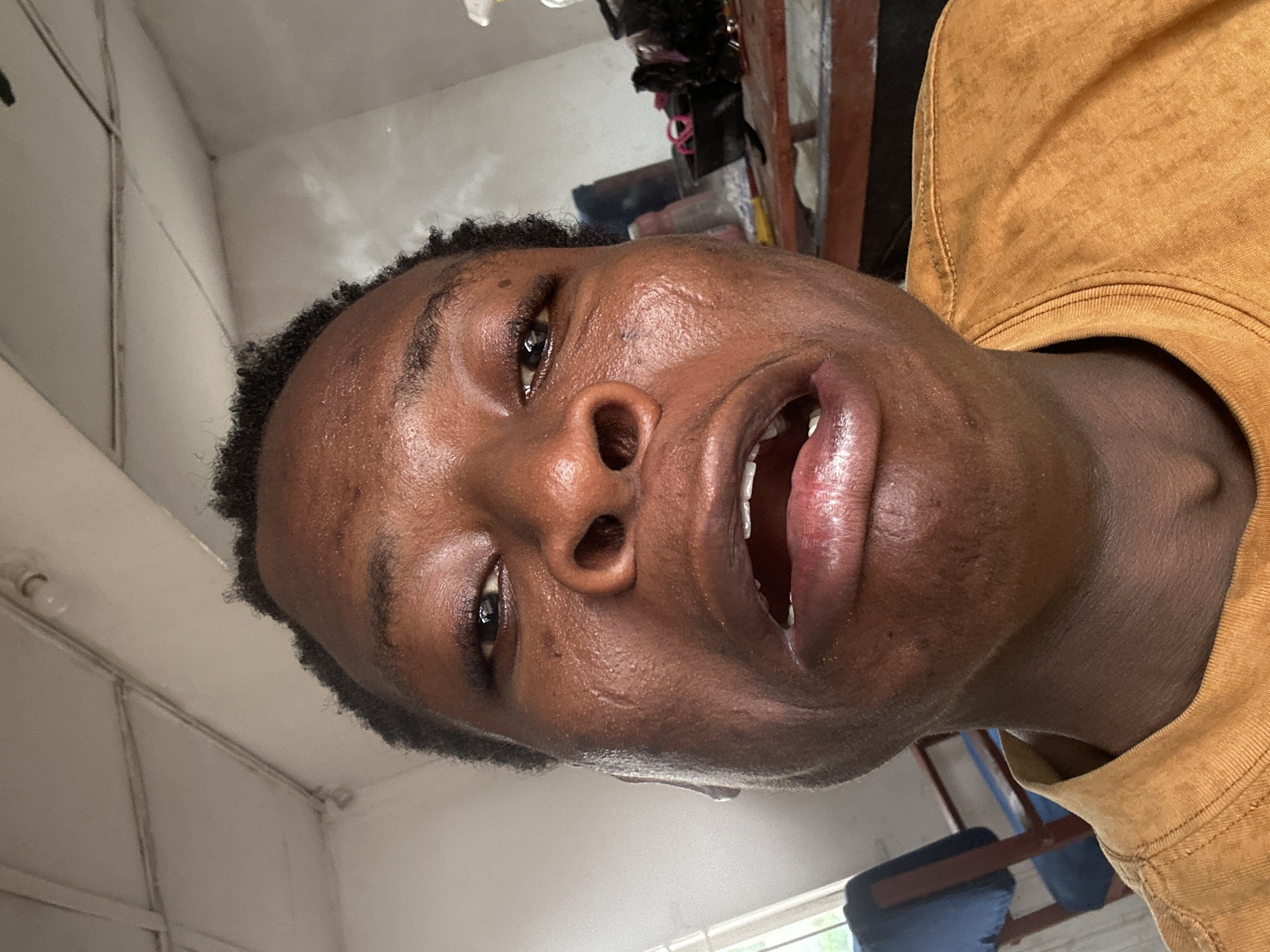 The image is a close-up portrait of a person with dark skin and short, curly dark hair, rotated ninety degrees clockwise. The person's face is prominent, viewed from a low angle looking upwards, with their mouth wide open, revealing teeth and tongue. Their right eye (from their perspective) is partially visible, and the skin on their forehead and cheek appears somewhat glossy, possibly from sweat. A few small blemishes and a noticeable linear mark are present on the right cheek, below the eye. The subject is wearing a mustard yellow or dark yellow crewneck shirt.
The background suggests an indoor setting, likely a room. Light-colored walls with faint lines or seams are visible, along with a corner where two surfaces meet. In the upper background (in the original image orientation), there are indistinct dark objects, possibly clutter. Towards the lower right of the background, a window reveals a glimpse of greenery outside.
The wide-open mouth and upward gaze suggest an animated expression, possibly indicating speech, laughter, surprise, or a strong reaction. The lighting appears to be natural, consistent with daytime. No text is visible in the image.