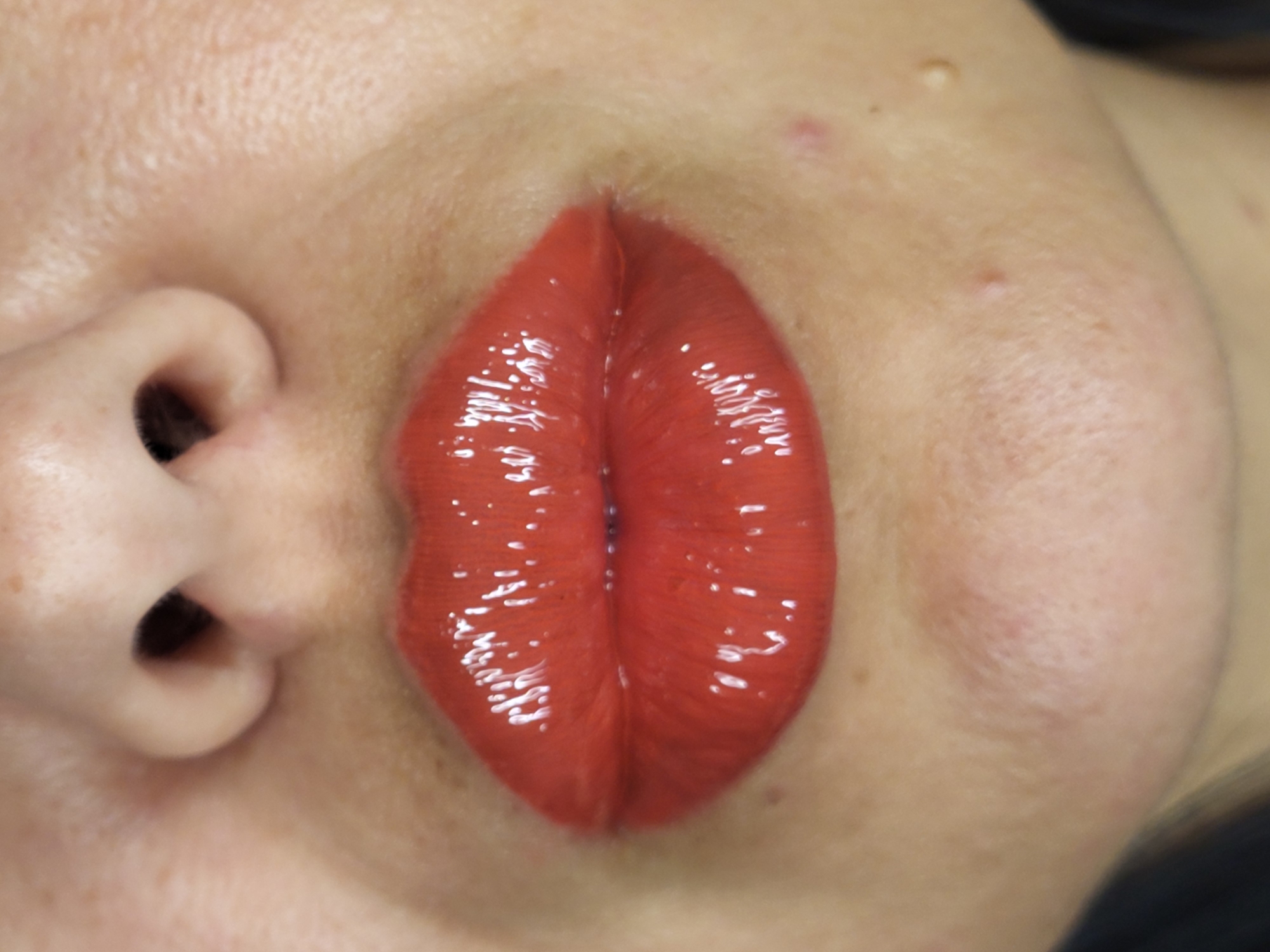 The image is a close-up, head-on, eye-level shot of a person's lips and the lower part of their nose. The lips are painted with a glossy, vibrant orange-red lipstick, reflecting light with numerous bright highlights. The skin around the lips is fair with visible pores and a few blemishes, including small red pimples and a lighter-colored raised bump on the right side of the chin area. The nostrils are dark and visible. The background is blurred and appears to be a neutral, skin-toned color. There is no discernible indication of the city of Horishni Plavni, Ukraine, in the image.