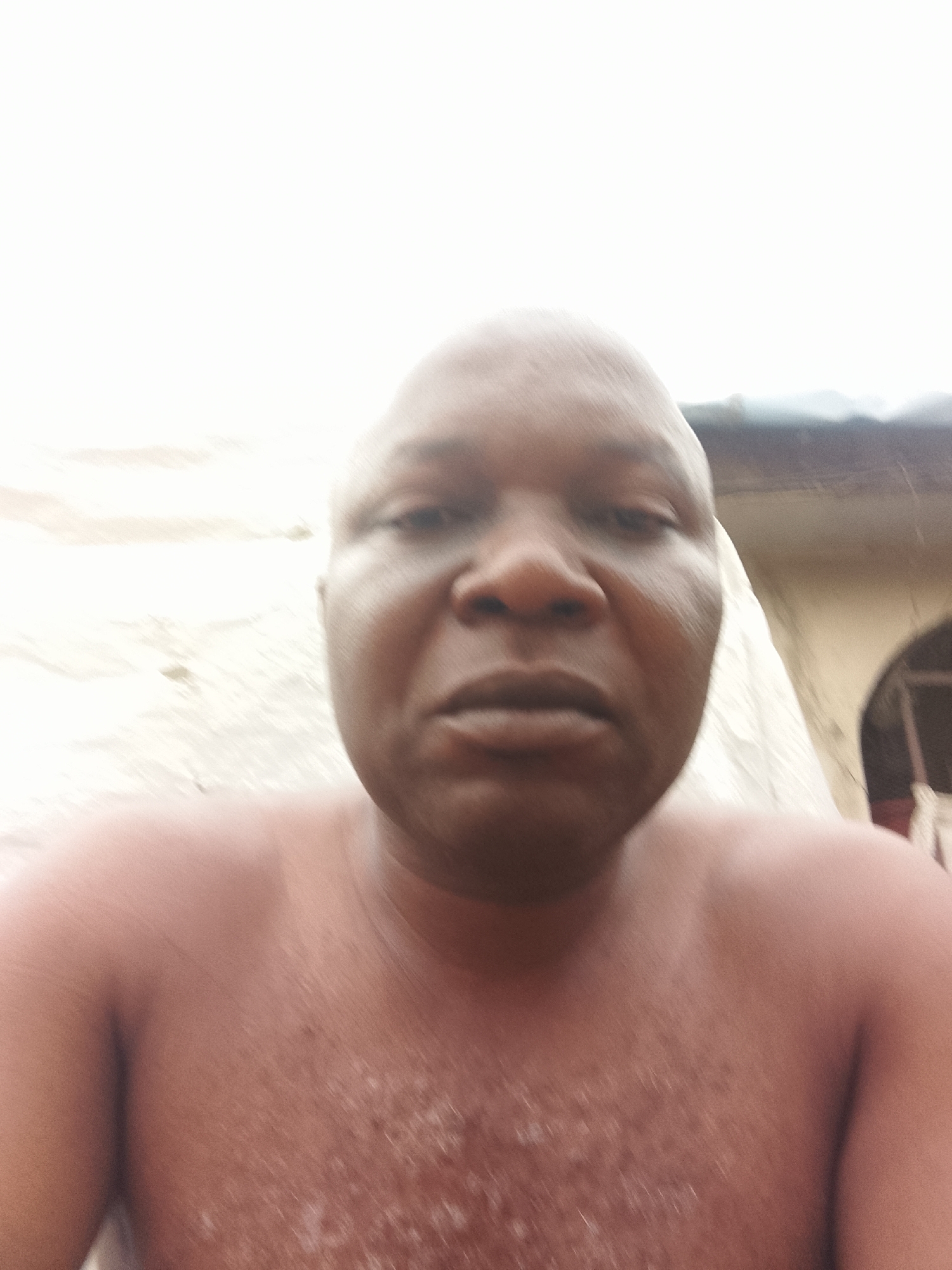 The image depicts a close-up, slightly blurred self-portrait of a dark-skinned adult male with a bald or closely shaved head, facing directly towards the camera. He is shirtless, revealing his upper chest and shoulders; the skin on his chest exhibits light-colored patches or textural variations. The background is overexposed and out of focus, indicating an outdoor setting at an unknown location within an unspecified city. On the left, a bright, indistinct, light-colored surface, possibly a wall or draped fabric, is visible. On the right, architectural elements of a building are present, including a dark roofline, a light-colored wall, and a partially obscured arched opening.