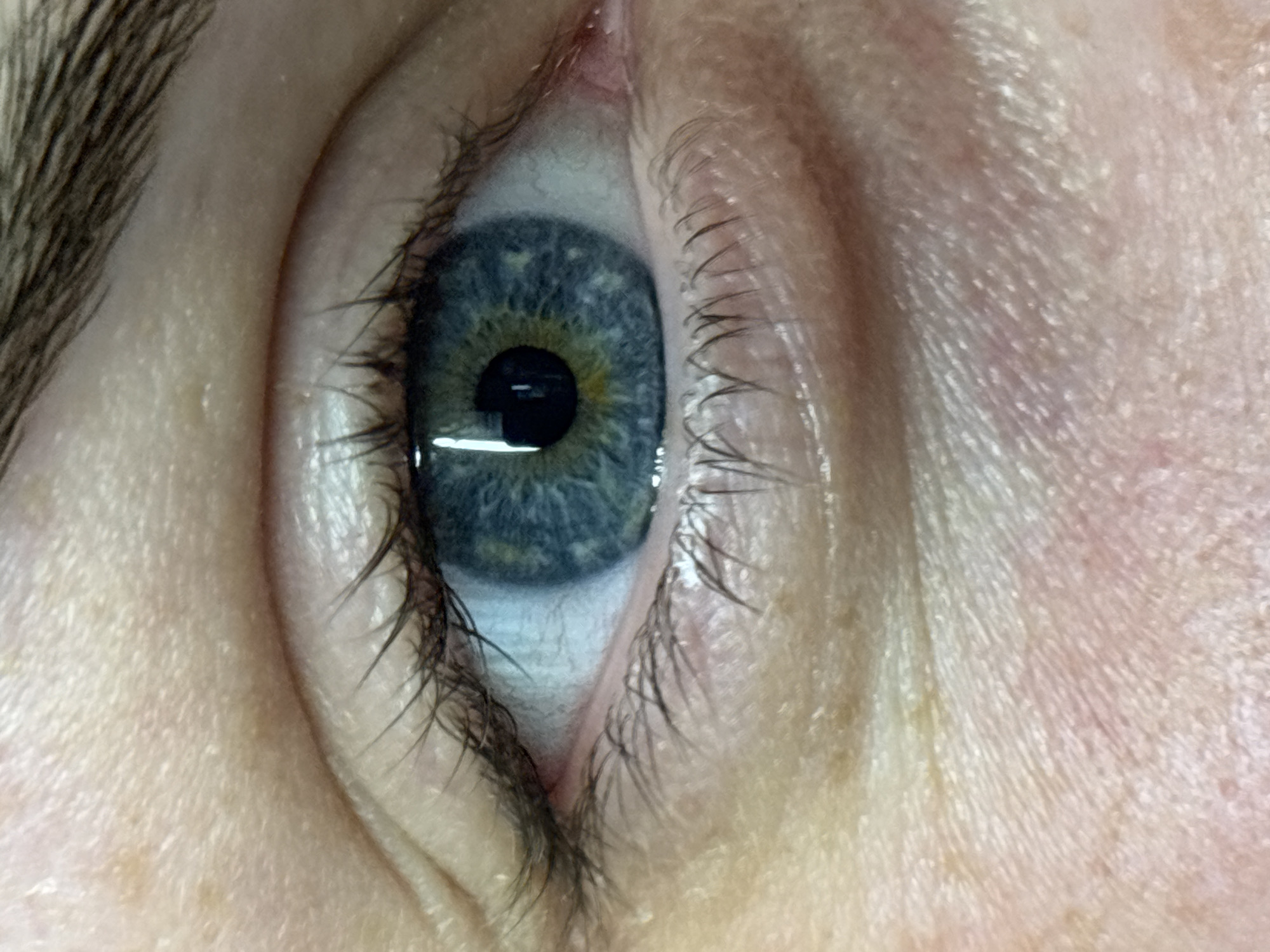 A close-up photograph shows a human eye. The iris is predominantly blue with some yellow/gold near the pupil. The pupil is black and has a rectangular reflection. Eyelashes are visible along the upper and lower eyelids. Skin surrounds the eye with visible fine lines. The image lacks geographic context, so providing a location in Chornomorskoe, Ukraine, is not possible.