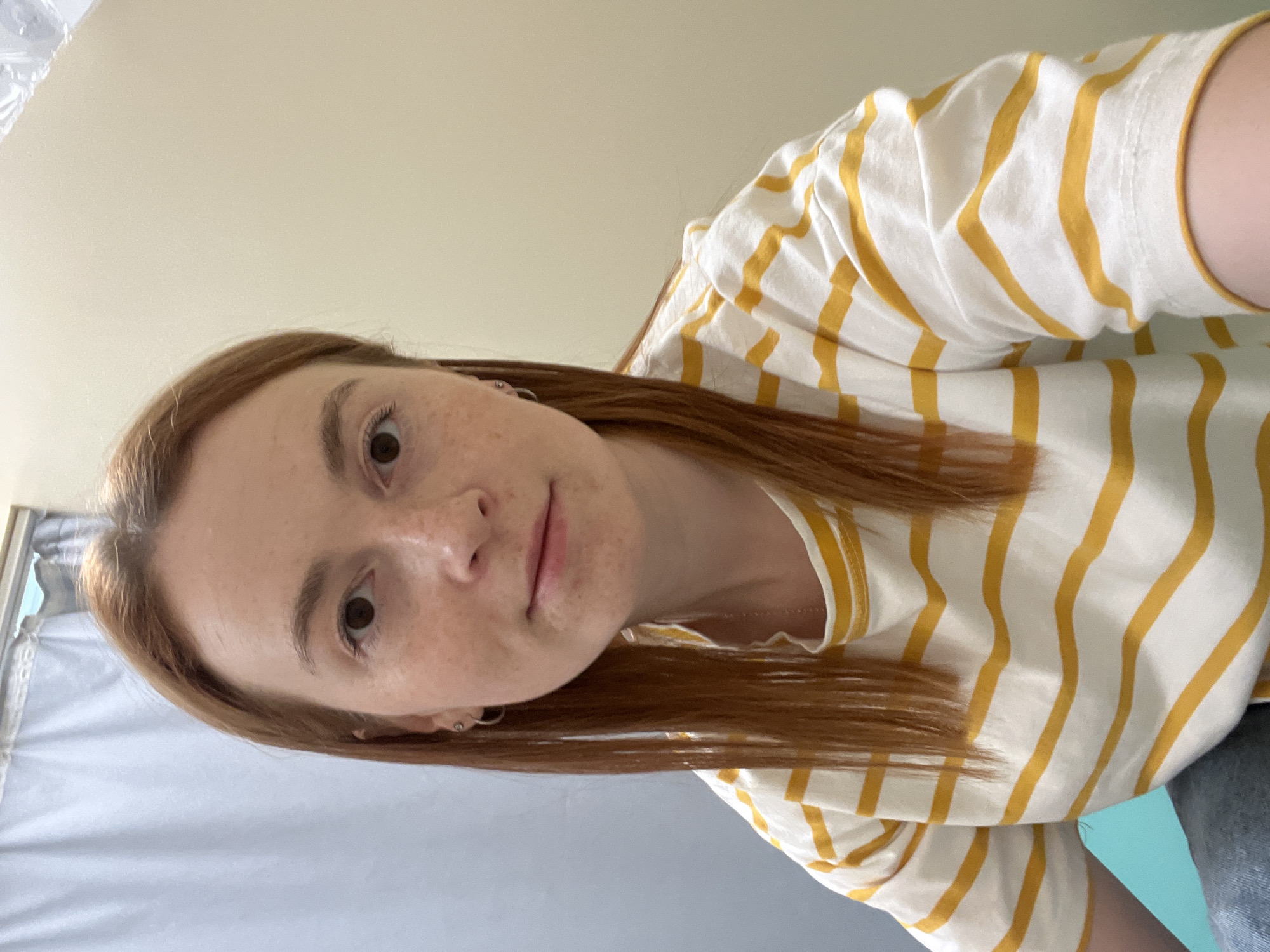 A young woman with freckled fair skin and reddish-brown hair is facing the camera. She is wearing a white shirt with yellow stripes. The background is a pale wall and a light blue surface. The photo appears to be taken indoors. There is no information in the image to suggest it was taken in Chaikovsky, Russia.