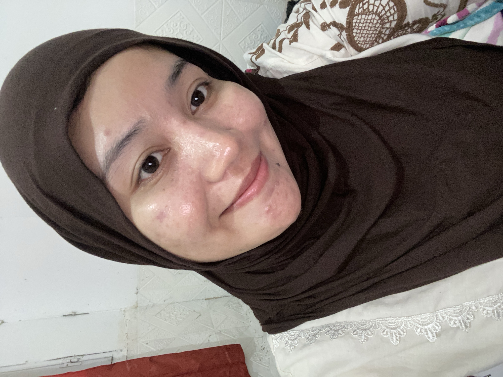 A young woman wearing a brown hijab and a white shirt with brown embroidery smiles at the camera. The woman has acne on her face and appears to be indoors, possibly in a home. The background consists of a tiled wall and a red curtain. The image is a selfie taken from a close-up angle, focusing on the woman's face. The overall lighting is bright, suggesting the presence of artificial or natural light sources. The scene is likely located in a residential setting within the city of Banjarbaru, Indonesia, given the context of the provided location.