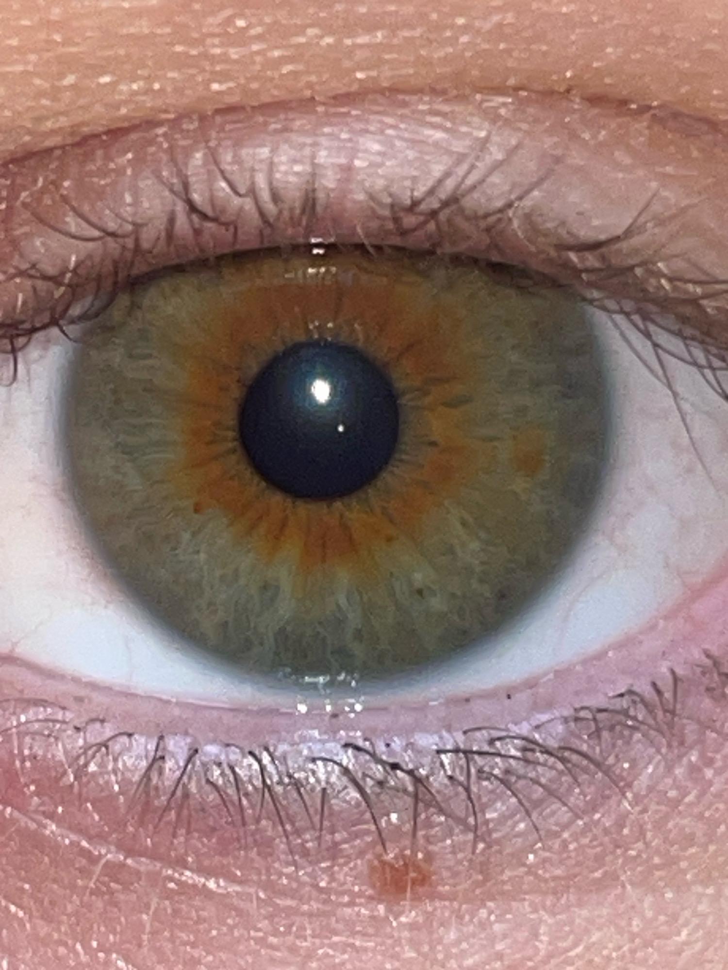 The image is an extreme close-up of a human eye, specifically focusing on the iris and surrounding eyelid. The iris exhibits heterochromia, with a dark pupil at the center surrounded by a ring of vibrant orange-brown, transitioning to a muted green-grey towards the outer edge. The skin of the eyelid is visible, with fine wrinkles and eyelashes. There is no indication of the location in Raanana, Israel, as this is a close-up of an anatomical feature, not a cityscape or any identifiable landmark.