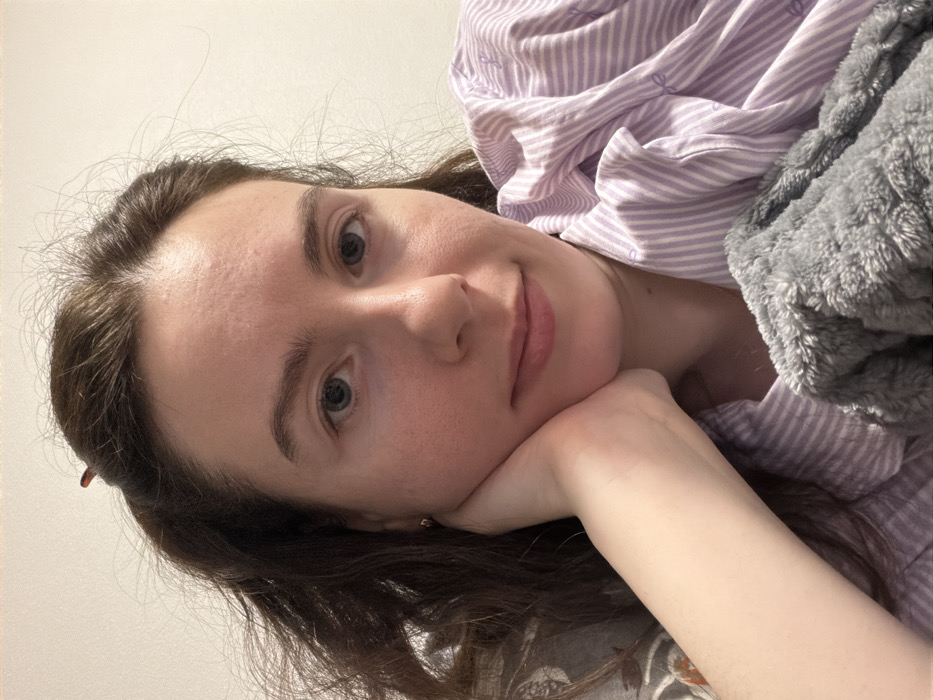 The image displays a close-up, head-and-shoulders portrait of a single female individual in an indoor setting. The individual has a pale complexion, light blue eyes, and dark brown, wavy hair that appears disheveled, with a dark hair clip visible at the crown of her head. She wears a light purple and white striped garment, possibly a pajama top, and a small metallic earring is visible in her left earlobe. Her left hand is positioned beneath her chin, partially supporting her head as she looks directly towards the camera with a subtle smile. A grey, textured, possibly faux fur blanket or throw covers her upper body on the right side of the frame. The background is a plain, light-colored wall. The specific location in the city of Ковалёво, Russia, cannot be determined from the visual information within the image.
