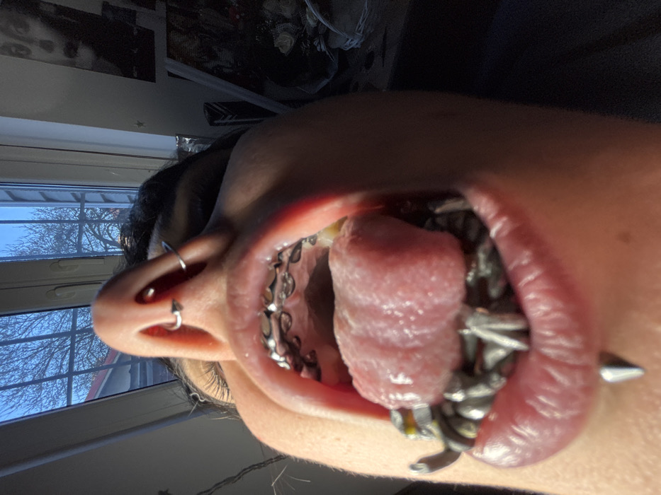 The image displays an extreme low-angle, close-up perspective of an individual's lower face, situated indoors in Sofia, Bulgaria. The subject's mouth is open wide. Metal orthodontic braces are visible on the upper dental arch. The tongue is extended slightly, appearing pink and moist. Within the lower oral cavity, numerous metallic, chain-like objects with pointed elements are present, resting on or near the lower gum line. A silver-colored spike stud pierces the center of the lower lip. The individual's nose exhibits a silver-colored hoop piercing in each nostril, and a silver horseshoe ring piercing through the nasal septum. Dark hair is visible at the top and sides of the frame.
The background to the left features a large window with white framing, through which a clear blue sky and bare tree branches are visible, along with a portion of a red-roofed building. Direct sunlight streams through this window. The background to the right reveals a wall adorned with several dark-toned framed pictures or posters, one depicting a stylized figure with a potentially macabre aesthetic. White, sheer decorative fabric is also present on the right side of the frame.