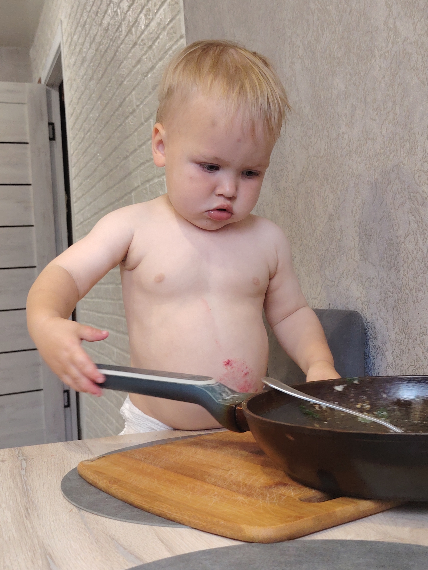 A young, shirtless child with blond hair is standing at a table, looking down. The child is wearing a diaper. There is a red, inflamed rash on the lower left side of the child's abdomen. A frying pan with a spoon in it sits on a wooden cutting board on the table in front of the child. The background shows a tiled wall and part of a doorway with horizontal panels. The scene appears to be indoors, likely in a kitchen, given the presence of cooking utensils. The lighting suggests it is daytime.