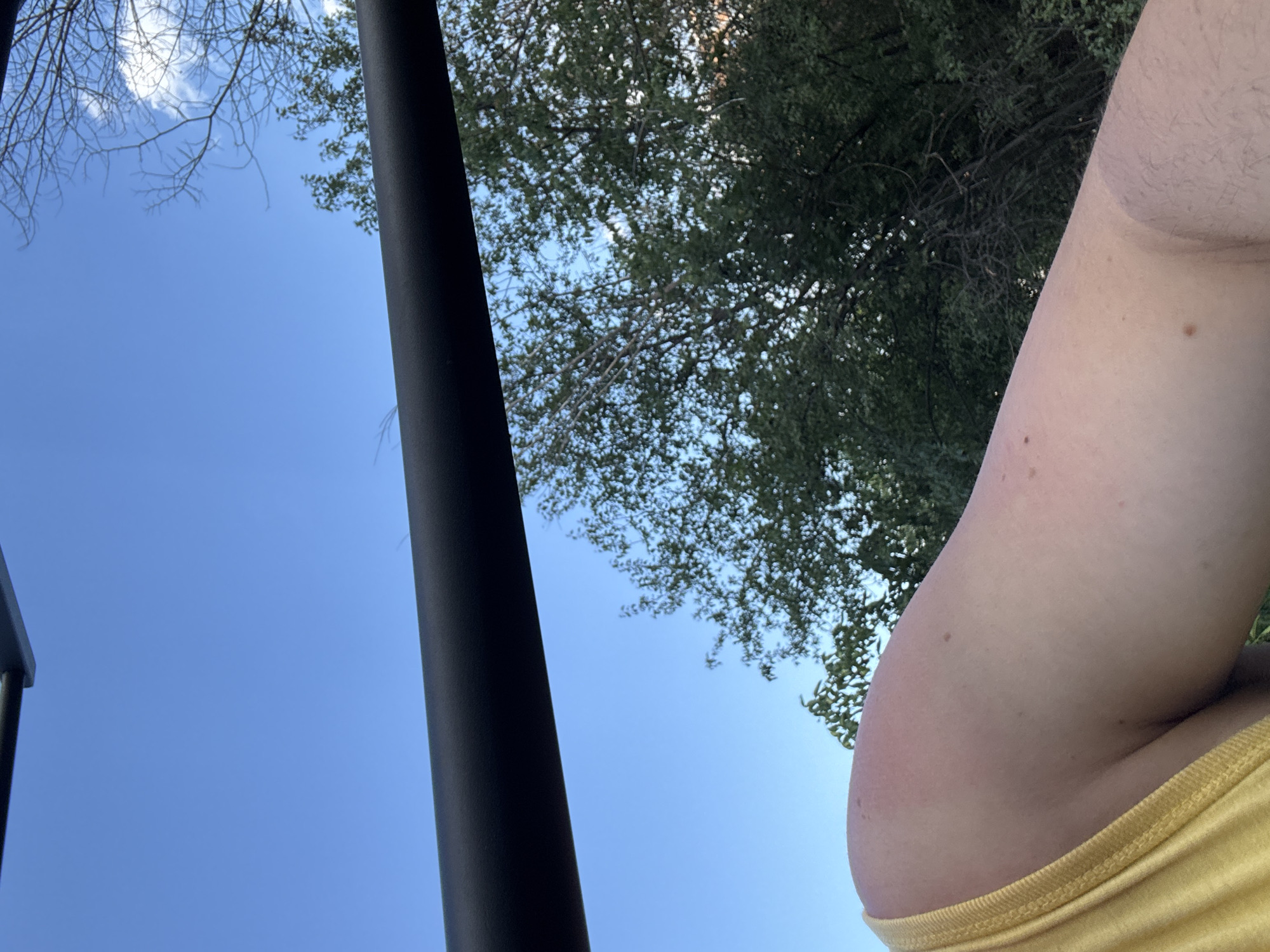 A close-up shot captures a person's arm and shoulder against a backdrop of a clear blue sky and green trees. The person is wearing a yellow garment. A dark, horizontal bar traverses the top of the image, partially obscuring the sky and trees. The arm shows signs of sunburn, with a reddish hue on the shoulder. The scene appears to be outdoors, possibly in a park or natural setting within Stara Zagora, Bulgaria.