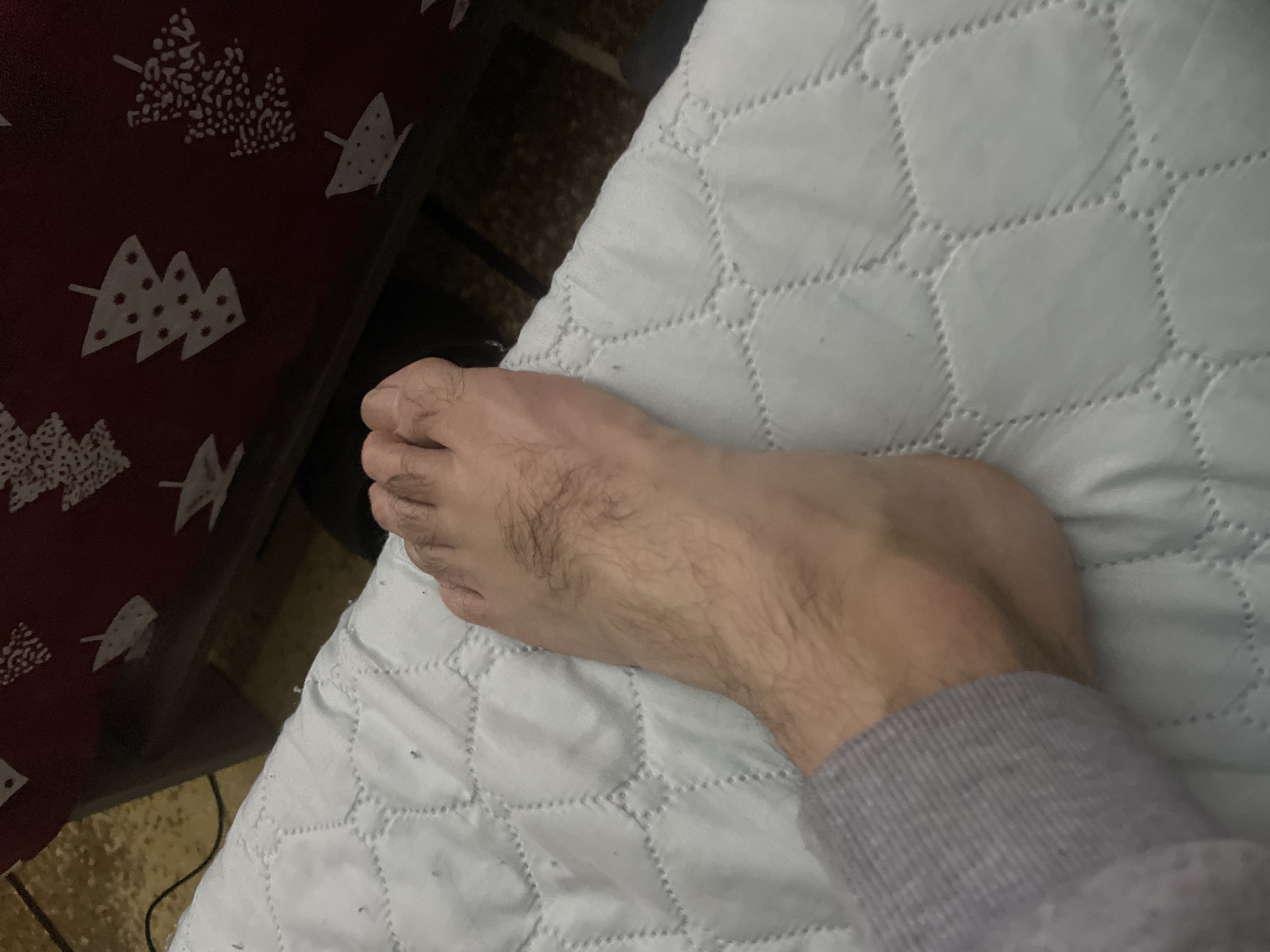 A human foot rests on a white, quilted surface, likely a bed or padded furniture. The foot is hairy. The lower portion of a grey sleeve is visible near the ankle. To the left of the white surface, a red surface with white Christmas tree patterns is visible. The image was not taken in Sofia, Bulgaria. No information indicates location.