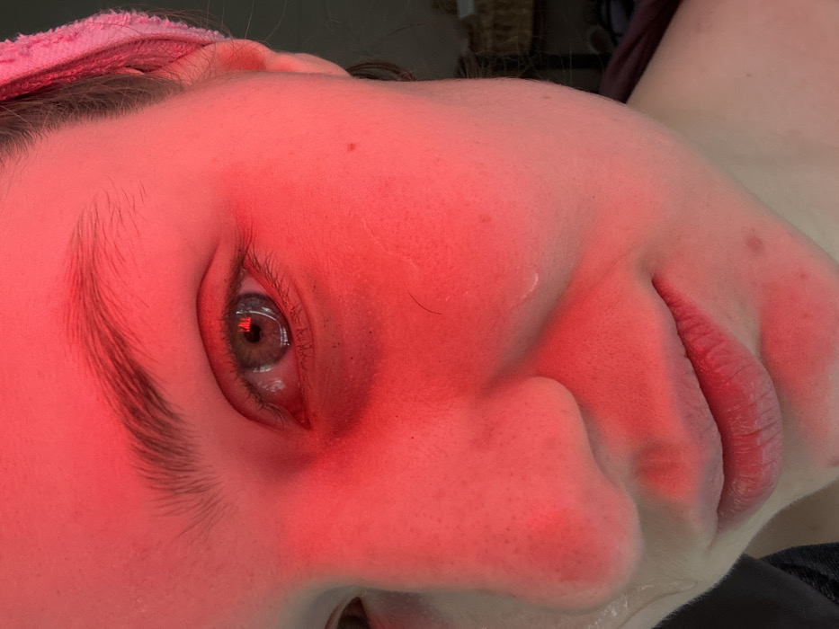 A close-up, angled shot of a person's face bathed in red light. The eye is prominent, with a reflection in the pupil. The nose, lips, and skin show details of texture and pores under the red illumination. A pink headband is visible at the top of the frame. The angle gives an upward view of the face.
