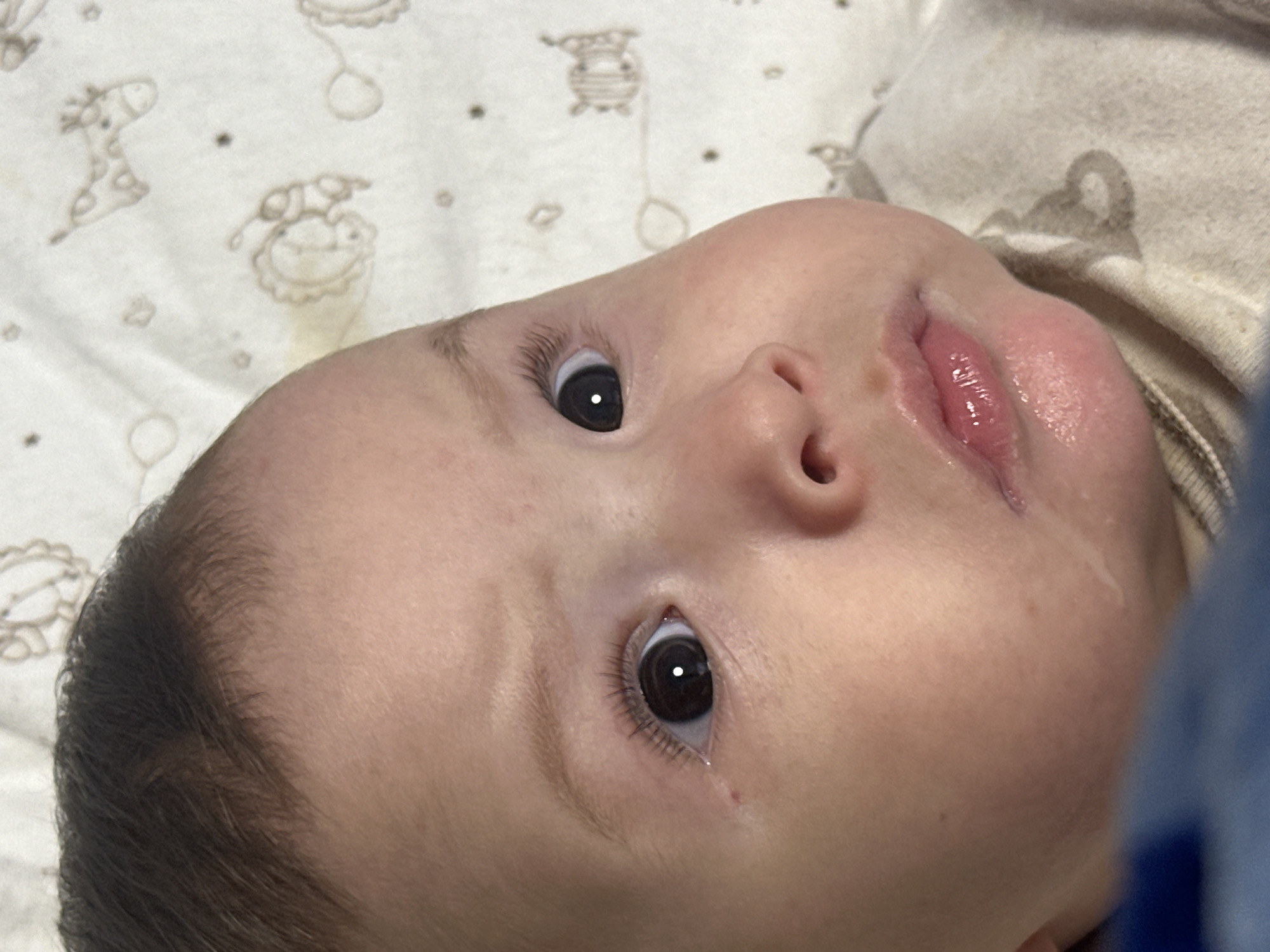 A close-up, head-and-shoulders portrait of an infant is depicted. The infant faces forward, with its head slightly tilted upwards and to the viewer's right. Its dark, wide-set eyes are open and directed slightly above the camera's lens, with distinct white specular highlights visible in both pupils. The infant has fair skin, plump cheeks, and a small, slightly upturned nose. Dark brown hair is visible on the top of the head, and fine, light-colored eyebrows are present above each eye. Distinct dark eyelashes are visible on both eyelids. A small, linear reddish mark or scratch is observed below the outer corner of the infant's left eye. The lips are pink, full, and slightly parted. An accumulation of clear liquid (drool) is present on the lower lip and chin area. The infant is dressed in a light-colored (cream or tan) long-sleeved garment, partially visible on the lower right side of the frame. The background consists of a light-colored (off-white) fabric surface, likely a blanket or sheet, adorned with faint, light brown patterned illustrations of various animals and shapes. A blurry, indistinct blue object partially obscures the lower left corner of the frame. The specific location is indeterminate.
