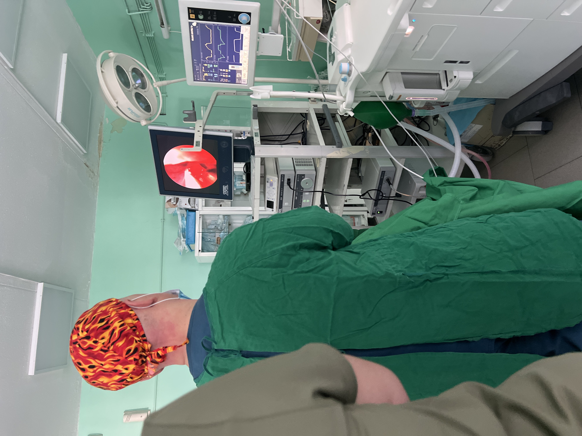 This media file depicts an interior scene from a medical environment, specifically an operating room or a procedural suite, likely in Burgas, Bulgaria. The image is taken from a low angle, showing the back of a medical professional and various pieces of medical equipment.
The primary subject is a person, presumably a surgeon or anesthesiologist, viewed from behind. They are wearing a vibrant surgical scrub cap adorned with a red, orange, and yellow flame pattern, along with a green surgical gown. Their focus appears to be on the medical monitors and equipment. In the immediate foreground, part of another person's shoulder and arm, dressed in a grey/khaki top, is visible, indicating the viewpoint of the photographer.
The room is equipped with an array of medical technology. A large, white ventilator or anesthesia machine is prominent on the right side of the frame, connected by various tubes and wires. Above and to the left, multiple digital monitors display complex medical data, including waveforms and numerical values pertinent to patient vital signs or machine settings. Below these, a dedicated monitor clearly shows a magnified, reddish endoscopic view, indicating an internal body examination or surgical procedure. The brand name "STORZ" is visible on this monitor, identifying Karl Storz endoscopic equipment.
A circular surgical light fixture with multiple bulbs hangs from the ceiling, providing illumination to the operational area. The walls of the room are painted a light green, and some areas exhibit visible peeling paint, suggesting the facility might be older or in need of renovation. The overall scene conveys a sterile, functional setting indicative of a medical procedure actively taking place or about to begin.