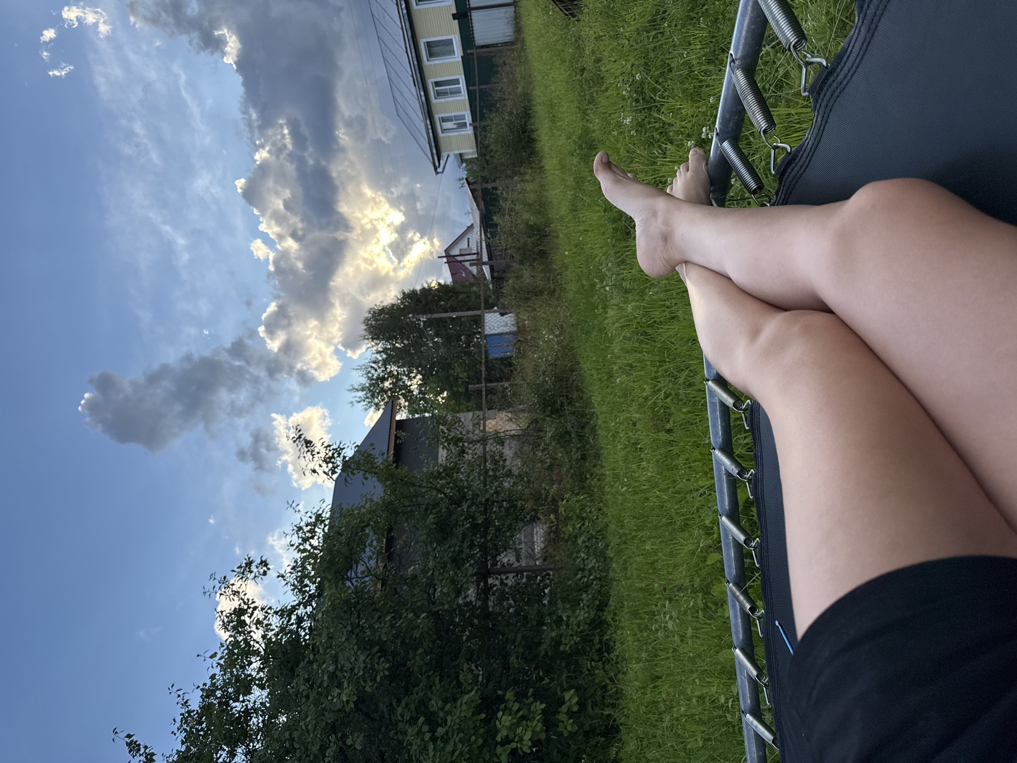 In the city of Vetluzhsky, Russia, a person's legs are visible, resting on a trampoline. The individual is wearing black shorts. The trampoline has visible springs. The background features a grassy yard with trees, a fence, and houses. The sky above is blue with scattered clouds, some of which are illuminated by sunlight.