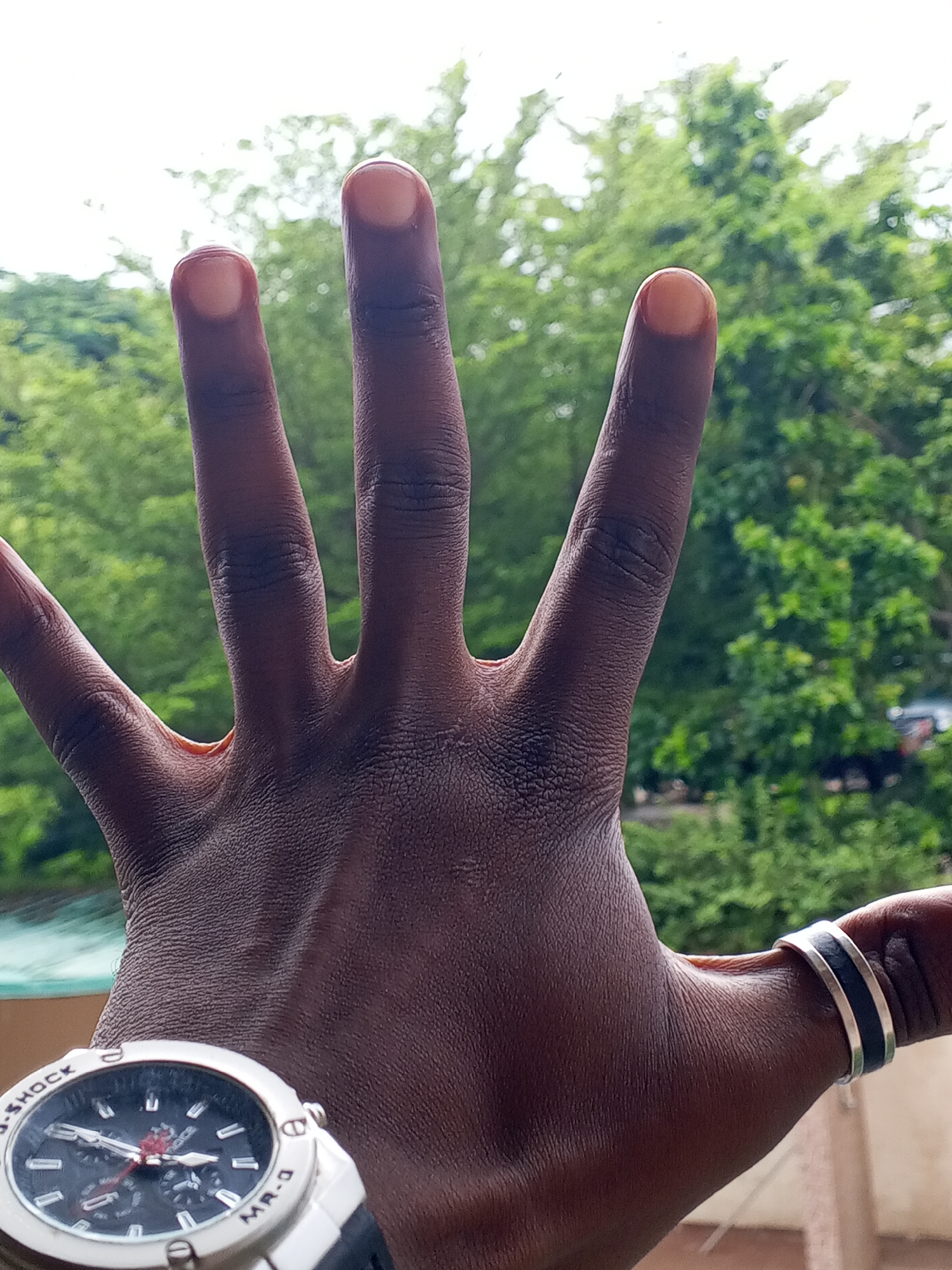 The image shows a close-up view of a dark-skinned person's left hand, palm facing the camera, against a blurred background of green foliage and sky. The fingers are extended, with the index, middle, and ring fingers appearing to be slightly bent. A black and silver ring is visible on the ring finger. A silver and black G-Shock wristwatch is worn on the wrist. The scene appears to be outdoors, possibly in a park or garden, with trees and possibly some structures visible in the distance. The lighting suggests it is daytime, with an overcast sky.