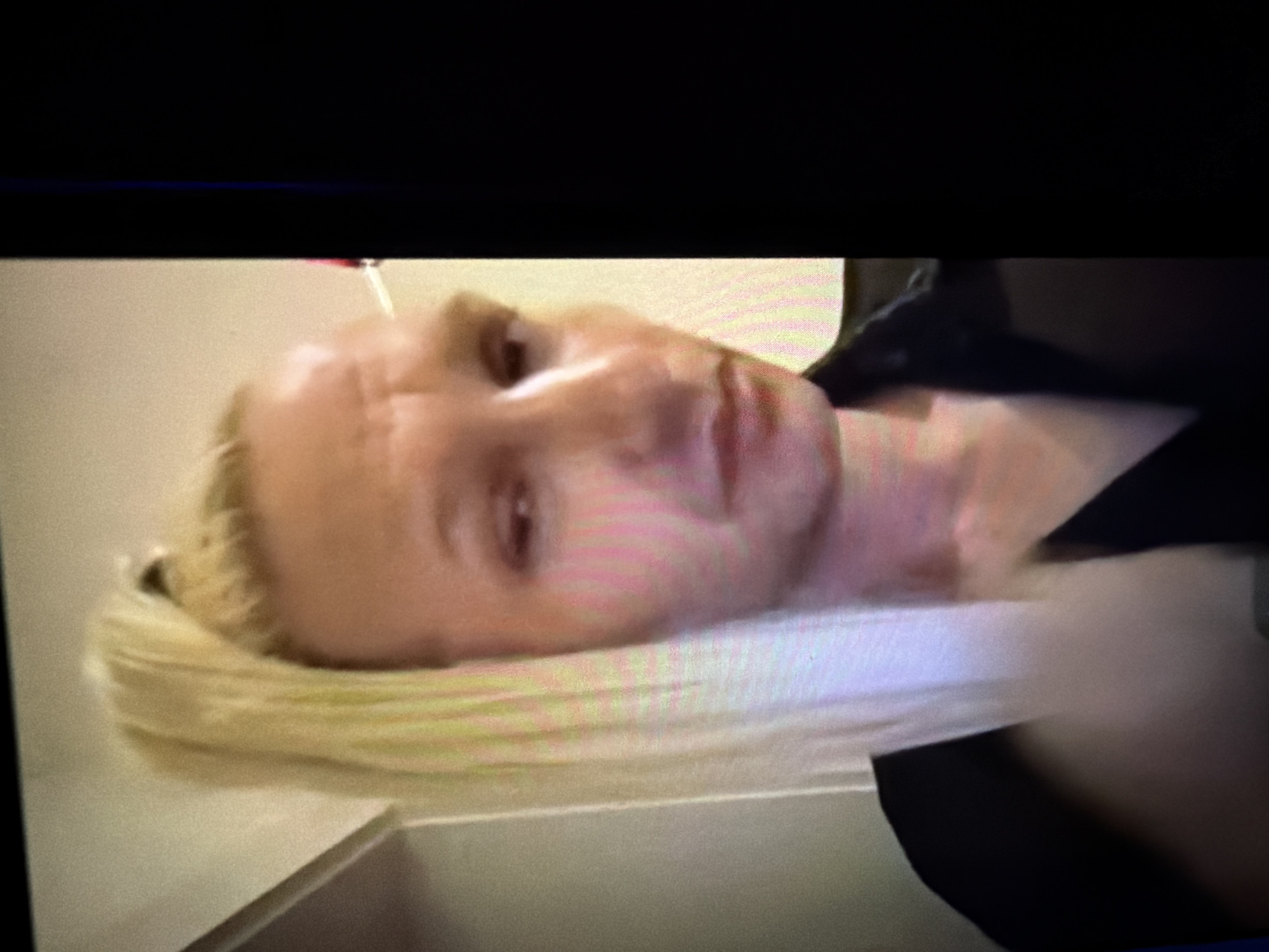The media file is a photograph of a digital screen displaying a person's face. The subject is a person, likely female, with blonde hair pulled back, visible from approximately the chest or shoulders up. The person is positioned horizontally, with their head tilted slightly to the right, giving the impression they are lying down or reclined. Their expression is neutral, with a slight solemnness, and some lines are visible on their forehead. Their eyes are open, looking directly towards the camera.
A thin, light-colored piece of fabric or material, possibly a towel or part of their attire, is visible beneath their neck and chin, extending towards the right side of the frame. The immediate background to the left of the subject is a light-colored, possibly off-white, surface, which could be a wall or a flat counter. The top portion of the image and parts of the right side are dark, featuring a distinct thin, horizontal blue line, which is characteristic of a digital display being photographed.
The image quality is low, exhibiting pixelation and visible horizontal scan lines, consistent with a photo taken directly from a screen rather than a direct digital image. There is no discernible activity taking place beyond the person being observed or recorded. No specific time of day, weather, or other location cues are visible within the image itself, though the context provided indicates the location is Sofia, Bulgaria. No visible text is present in the image.