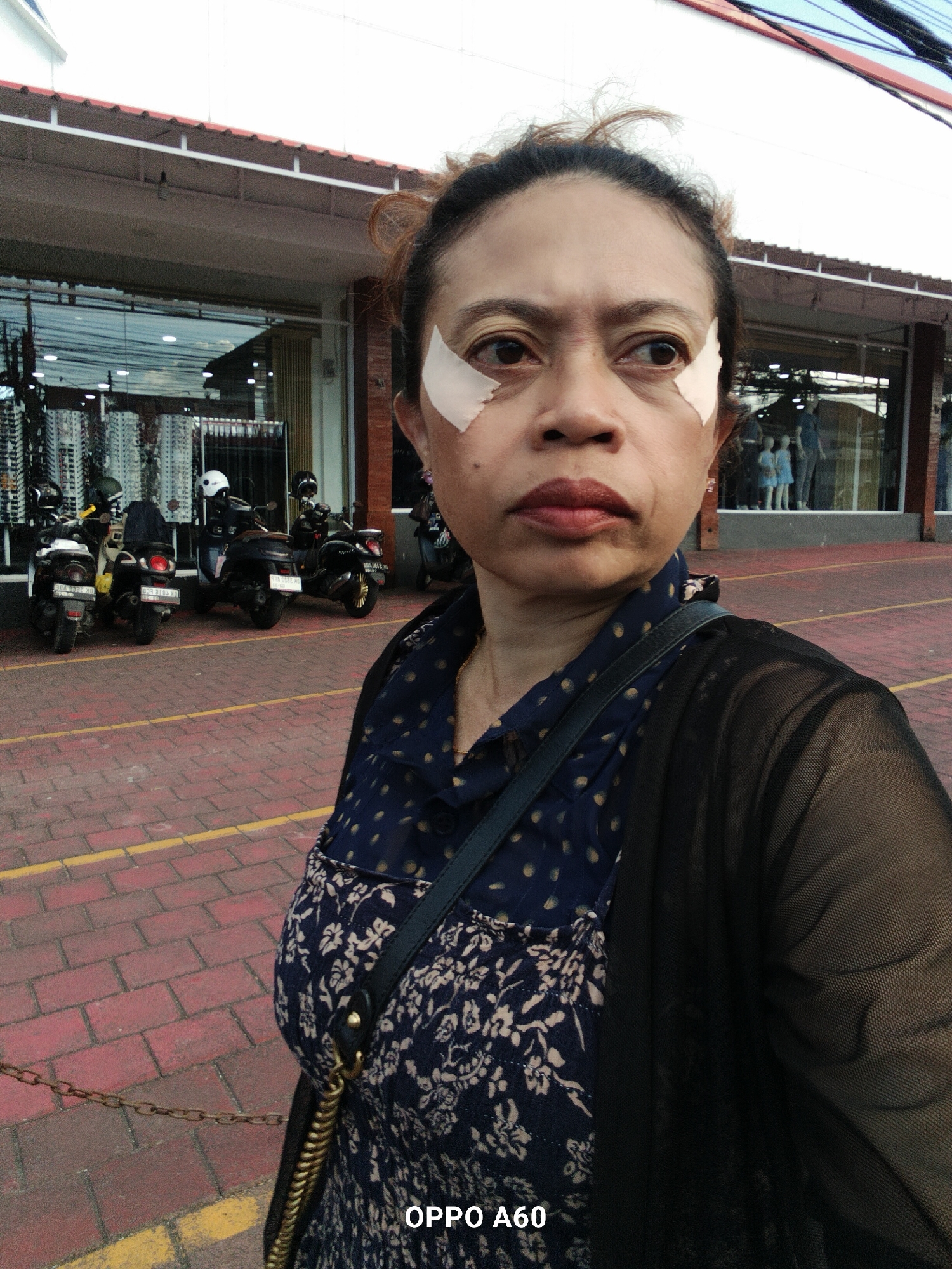 A medium shot selfie shows a woman with tan skin and dark hair, wearing a blue and white floral dress and a sheer black cardigan. She has two pieces of beige medical tape placed under her eyes. The woman is standing outdoors in front of a building with a covered walkway. The ground is paved with red bricks and yellow lines. Several motorcycles are parked in a row behind her. In the background, a store window displays mannequins dressed in clothing. The scene appears to be a commercial area in North Kuta, Indonesia.