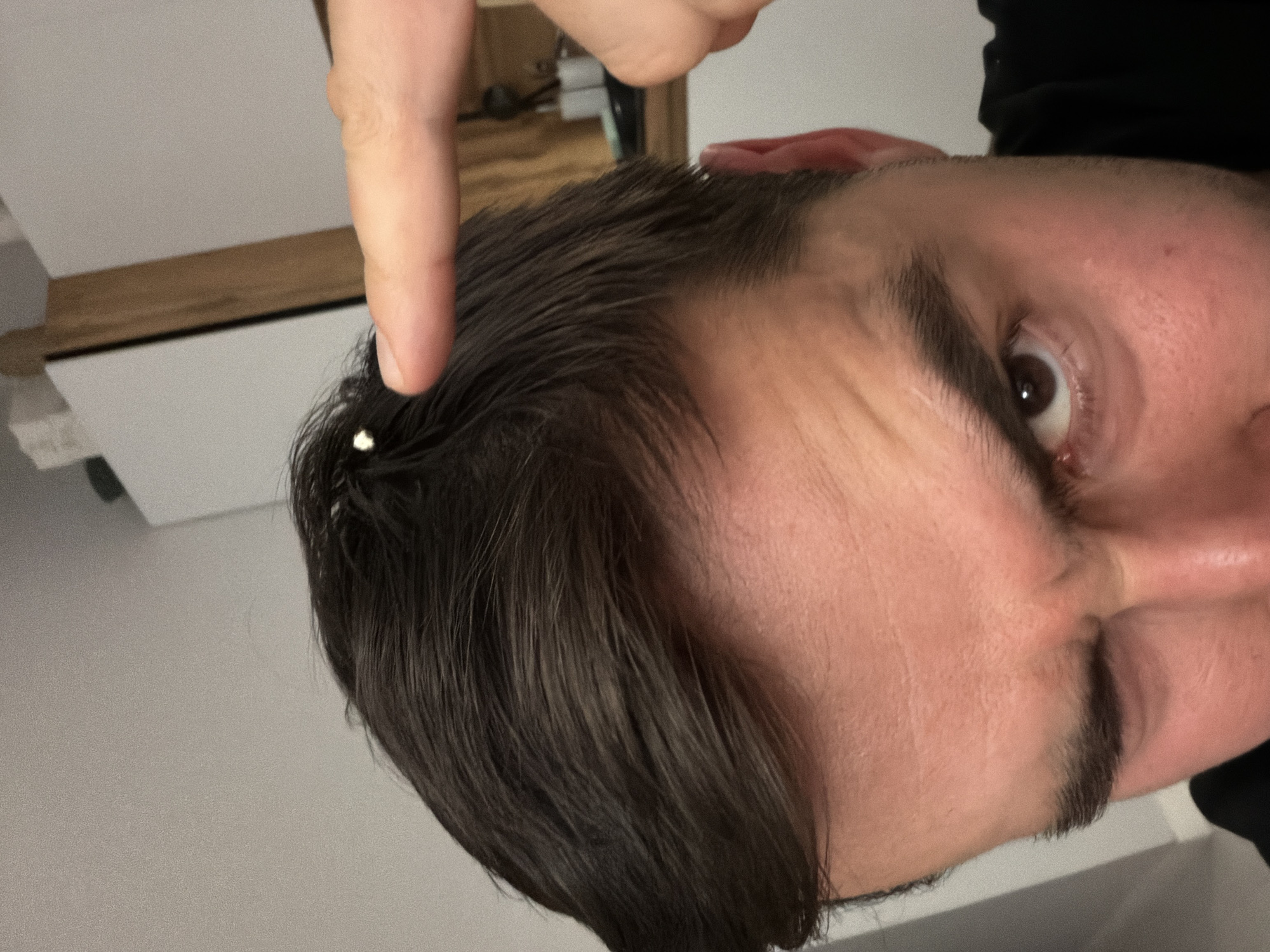 This close-up image, rotated 90 degrees, features the upper right side of a person's head and face. A finger, presumably belonging to the same individual or another person, points directly at a small, bright white object resting on the dark hair near the temple.
The subject is a person with dark brown, somewhat damp-looking hair. Their right eye, brown in color, is wide open and looks directly towards the viewer. The skin appears fair, with visible subtle lines on the forehead and around the eye, suggesting an attentive or focused expression. Dark, well-defined eyebrows are also prominent. The finger pointing at the hair has a clean, natural fingernail.
The white object is small and contrasts sharply with the dark hair, appearing like a piece of lint, a flake, or a similar foreign particle.
The background is out of focus, showing light-colored walls or a ceiling, with a horizontal wooden trim or beam visible in the upper left, indicating an indoor setting. There is no visible text. The context places the location in Krasnoyarsk, Russia, but the image itself contains no specific location cues beyond the general indoor environment. The lighting appears to be artificial.