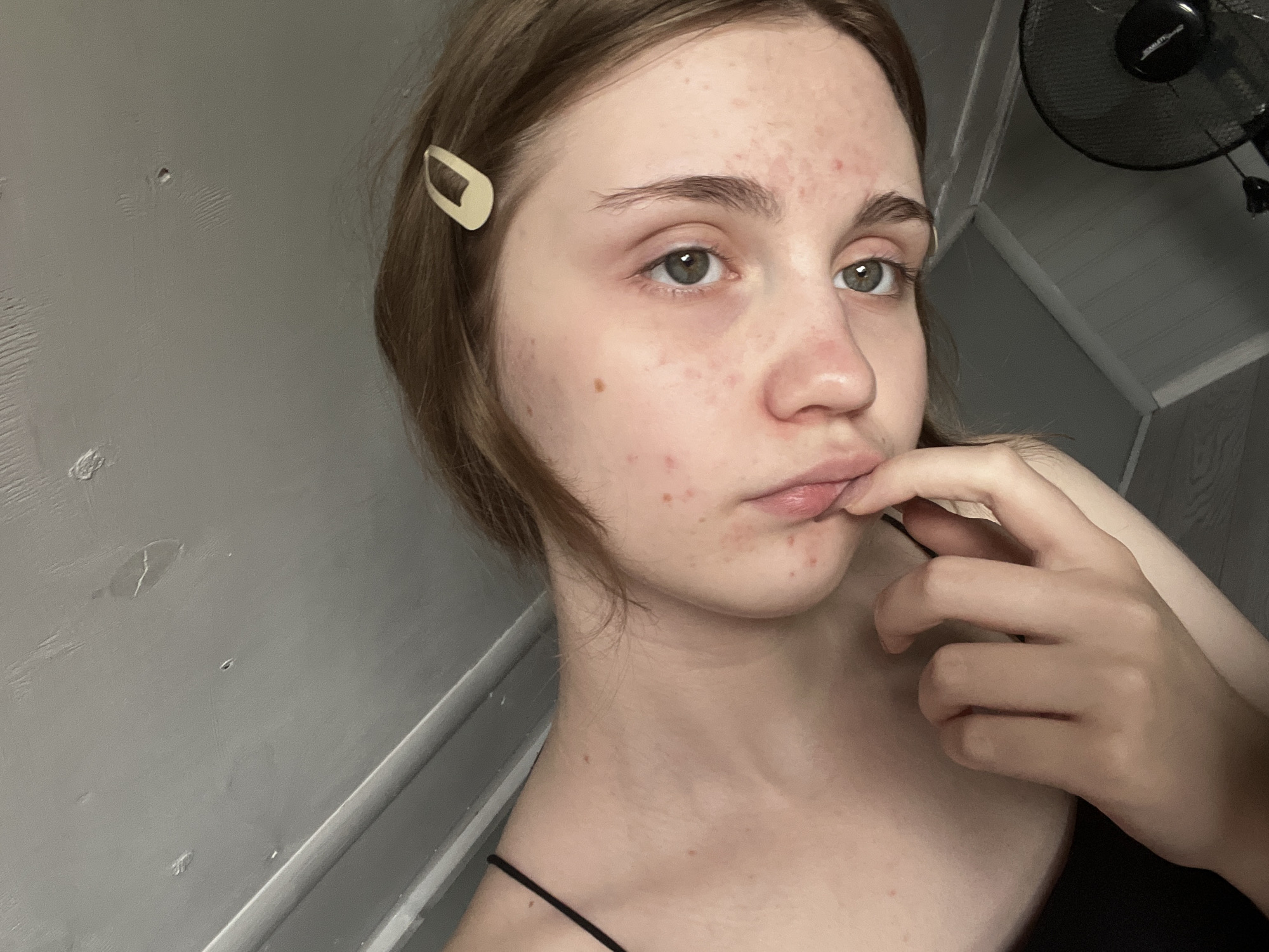 The media file is a close-up, high-angle selfie of a young person with light skin and brown hair, held back by a light-colored hair clip. The person is looking towards the camera with a neutral expression. Their face shows some redness and acne. They are wearing a dark-colored tank top. One hand is brought up to their mouth, with fingers touching the lips. The background is a textured, light gray wall with some scuff marks. In the upper right corner of the frame, a black fan is partially visible. The lighting appears to be indoor, possibly natural light coming from the side, as indicated by shadows on the wall. The overall scene is intimate and personal, suggesting a casual moment at home. There is no visible text in the image.