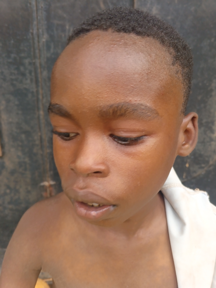 The image presents a close-up, three-quarter profile of a young, dark-skinned male child, located in Itu, Nigeria. The child's head is tilted downwards, with his eyes cast in the same direction. His hair is short, dark, and closely cropped. His mouth is slightly open, revealing some lower teeth. A light-colored fabric is draped over his left shoulder. The background is a dark, uniform surface with subtle vertical lines, consistent with a metal door or a painted wall.