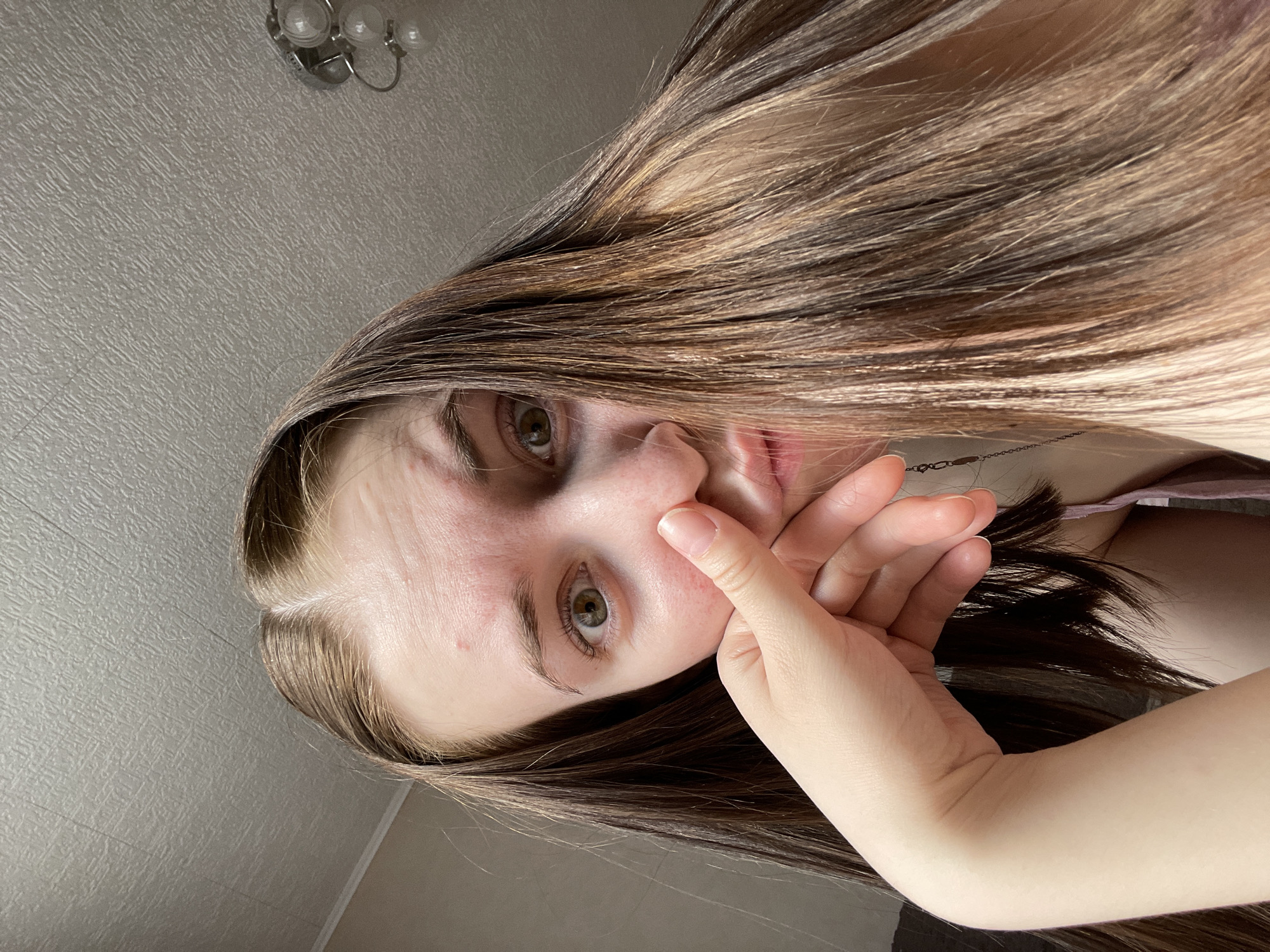 A young person with long, light brown hair is holding their hand to their face. The person has light skin, green eyes, and visible acne on their forehead and cheeks. The background is a textured, light gray wall with a multi-bulb light fixture visible in the upper left corner. The scene is indoors, possibly in a private residence. Location in Chaikovsky, Russia cannot be verified.