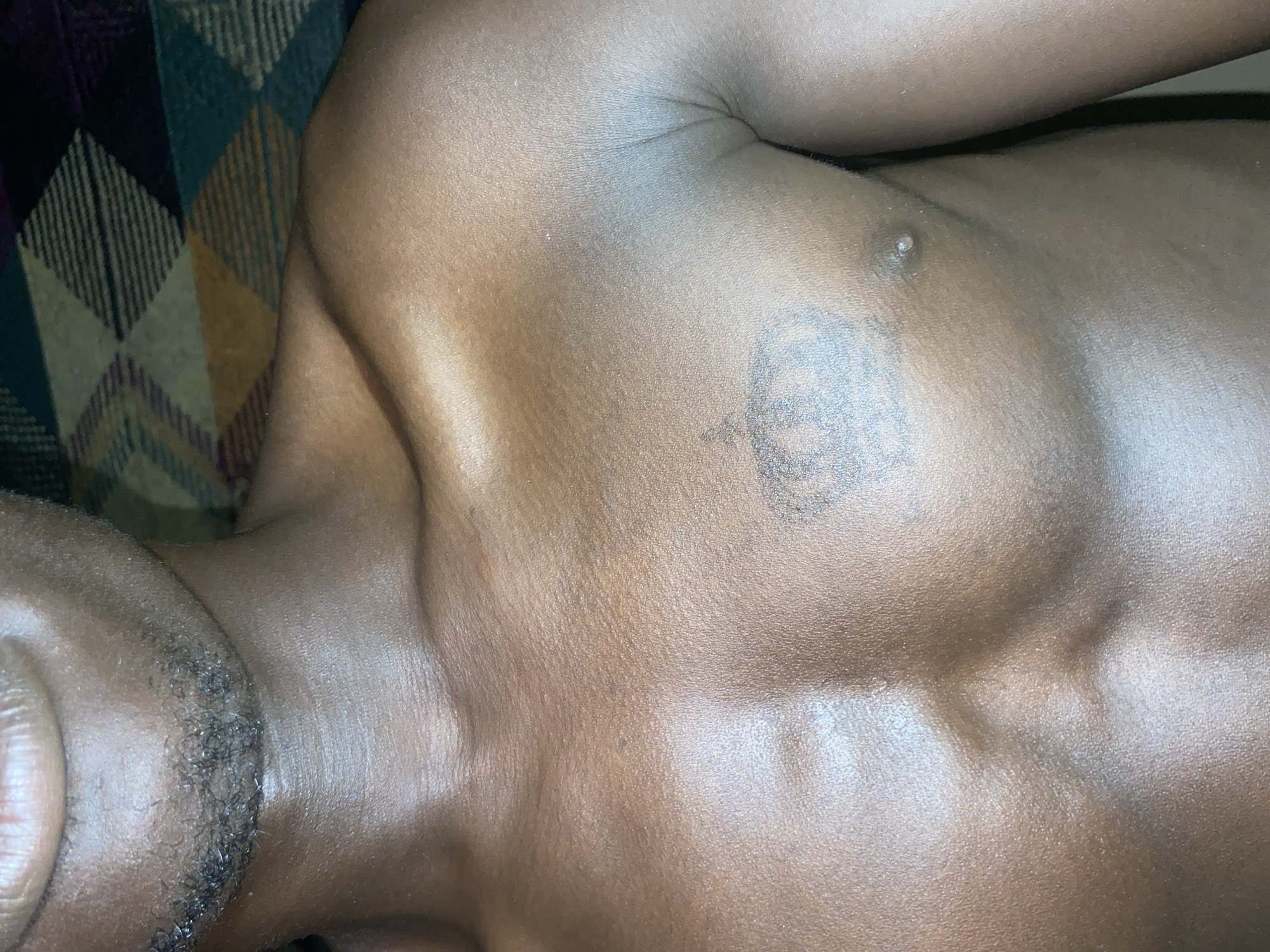 A close-up image shows the upper torso of a dark-skinned individual lying on a patterned surface. The person's left shoulder and part of their face (mouth and beard area) are visible. A small mole is present on the upper chest near a circular tattoo. The background is a patterned fabric with shades of green, yellow, and purple. The location, Barden Yana, Nigeria, is not discernible from the visual information provided.