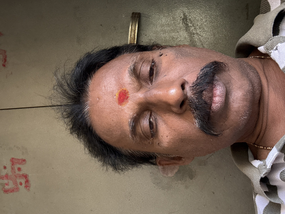 This close-up portrait features an adult man, likely in his middle age, lying down with his head positioned towards the left side of the frame. He has dark, slightly graying hair and a thick, dark mustache. A red and yellow bindi is prominently placed on his forehead. His eyes are closed or heavily lidded, suggesting he is resting or asleep, and his facial expression appears peaceful. Around his neck, a thin gold-colored chain is visible, and a striped, light-colored fabric, possibly a towel or blanket, partially covers his right shoulder and chest.
The background consists of a light gray or beige surface, resembling a tiled or concrete floor. To the left and slightly below the man's head, a red painted Swastika symbol is clearly visible on this surface. A brass-colored metallic object, possibly a handle or fixture, is visible near the top center edge of the frame. The lighting is soft and diffused, suggesting an indoor setting or a shaded outdoor area. No specific time of day or weather conditions can be definitively determined. The bindi and Swastika symbol are cultural cues consistent with the provided location context of Visakhapatnam, India. There is no other visible text in the image.