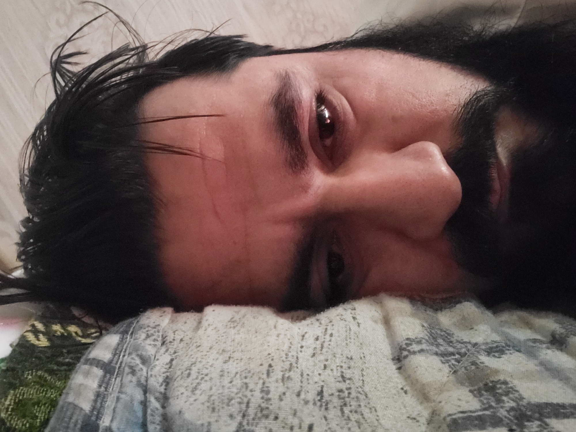 A close-up, angled shot shows a person's face resting on a patterned pillow or blanket. The person has dark hair, a beard, and is looking slightly upwards. Their eye appears bloodshot. There is no discernible information in the image to indicate a specific location in Quetta City Tehsil, Pakistan. The environment is limited to the immediate surroundings of the person's face and the pillow/blanket.