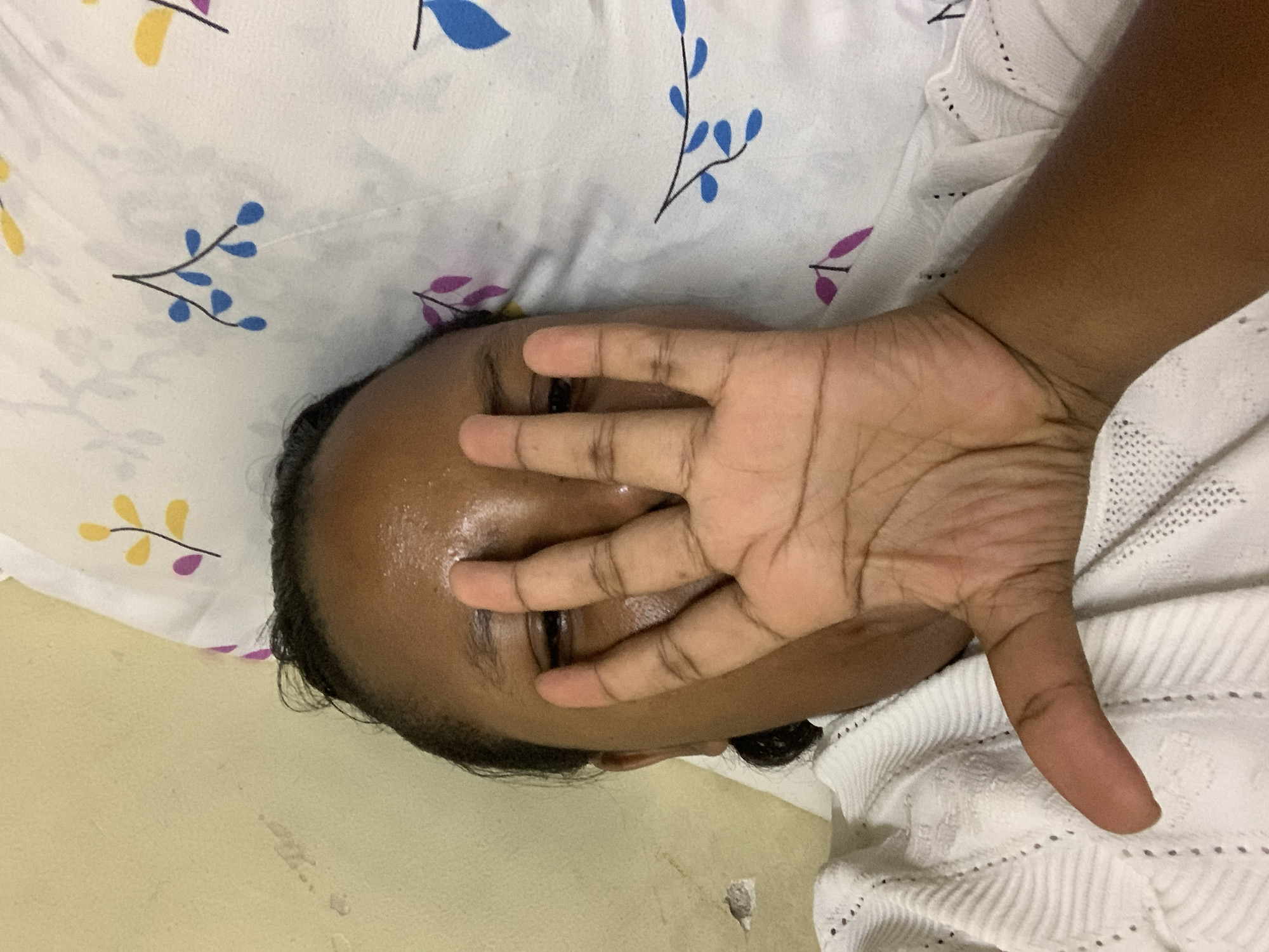 A person is lying on a white bedspread patterned with blue, yellow, and purple leaves. The person's face is partially obscured by their own hand. The person appears to have dark hair and skin. The person's forehead appears sweaty. A white knit garment is to the right of the person's face. The background includes a tan wall. The location is not discernible in the image.