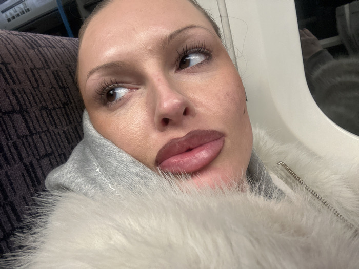 A close-up photo features a person with fair skin, likely female, with defined facial features and pronounced lips. She's wearing a light gray hooded garment, overlaid with a fluffy white jacket. Her expression is thoughtful, eyes glancing to the side. The setting appears to be inside a train car, evident from the seat and window reflections in the background.