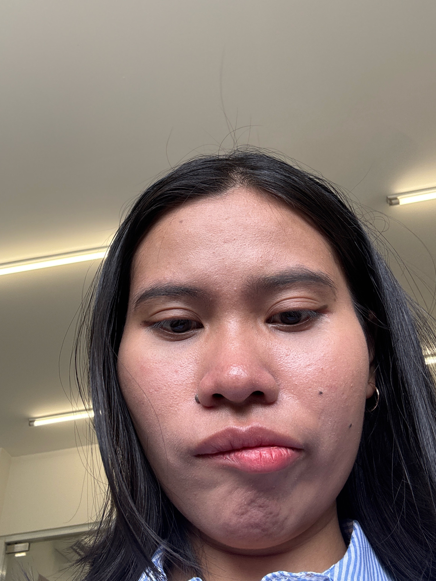 A close-up, low-angle selfie of a young woman with dark hair and brown eyes is captured in an indoor setting, likely an office or classroom. The woman is looking down towards the camera, with her face slightly tilted. Her skin appears to have some redness and a few small blemishes. She has a small black stud piercing on her left nostril and a small mole on her right cheek. Her lips are slightly parted, revealing a hint of her teeth. She is wearing a blue and white striped collared shirt. The background features a plain, light-colored ceiling with fluorescent lighting fixtures. The overall impression is of a casual, candid moment. The provided information about the image being taken in East Jakarta, Indonesia, is not visually discernible from the image itself.