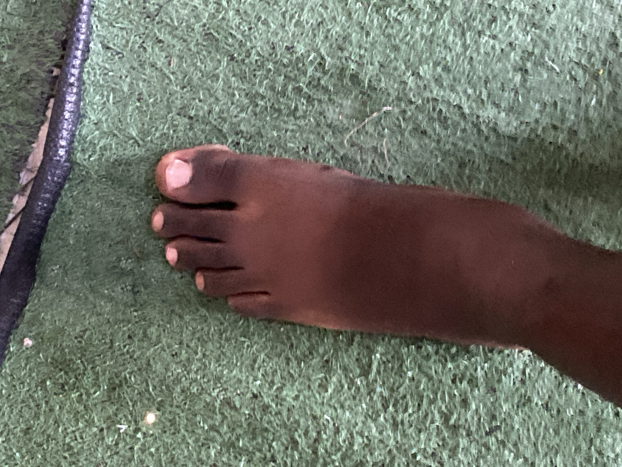 The image shows a close-up view of a dark-skinned foot resting on a green, artificial turf surface. The foot is positioned from the ankle downwards, with all five toes clearly visible. The toes appear to be cleanly trimmed. The artificial turf is textured and green, with some small white specks scattered across it. In the upper portion of the image, a dark, textured object, possibly a hose or a pipe, lies across the turf. The lighting suggests an outdoor setting, possibly during the day. The scene is devoid of any other identifiable human elements or specific landmarks that would pinpoint a location within Jauro Yinu, Nigeria.